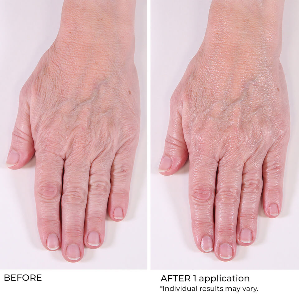 NassifMD Dermaceuticals Hand Treatment Cream 4 oz