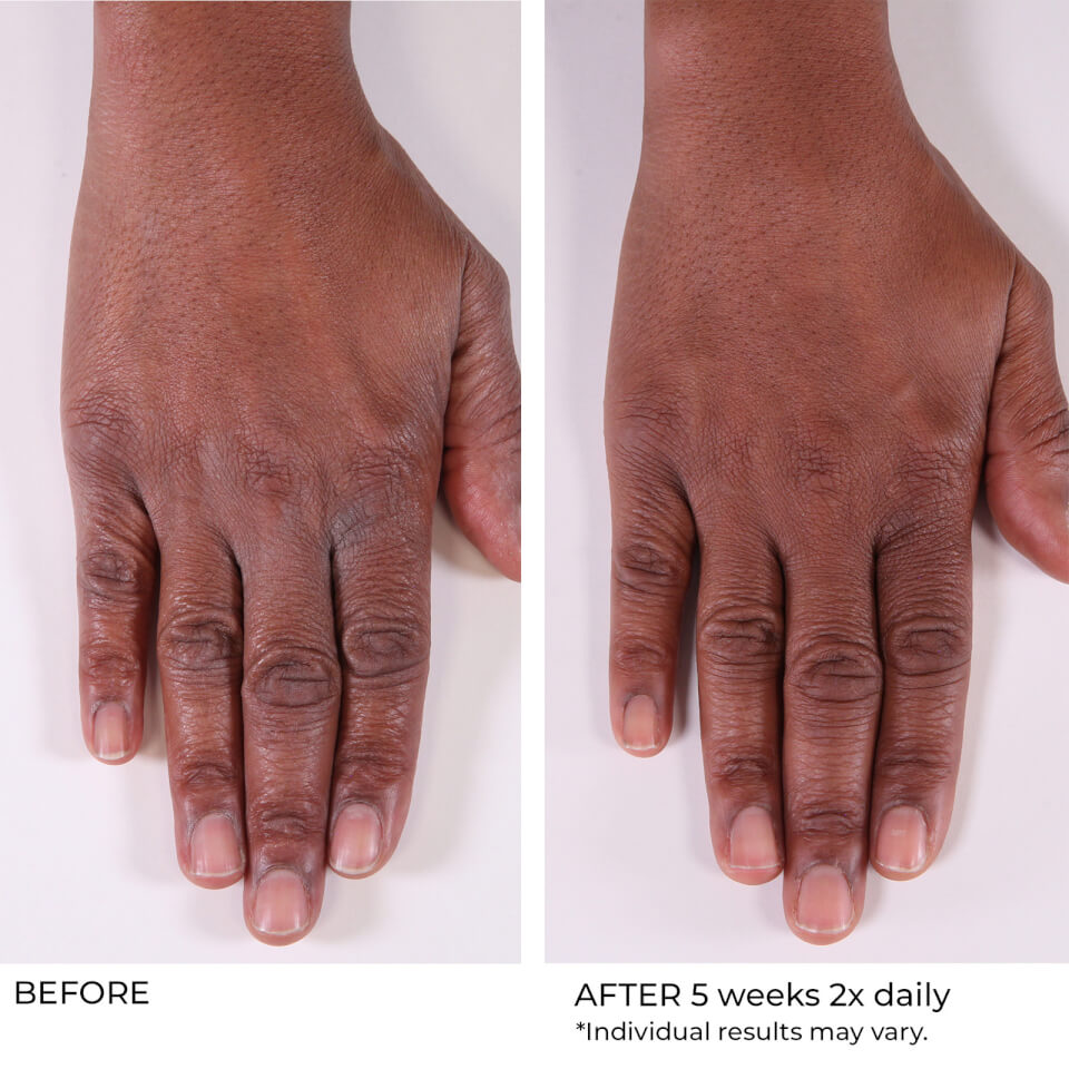 NassifMD Dermaceuticals Hand Treatment Cream 4 oz