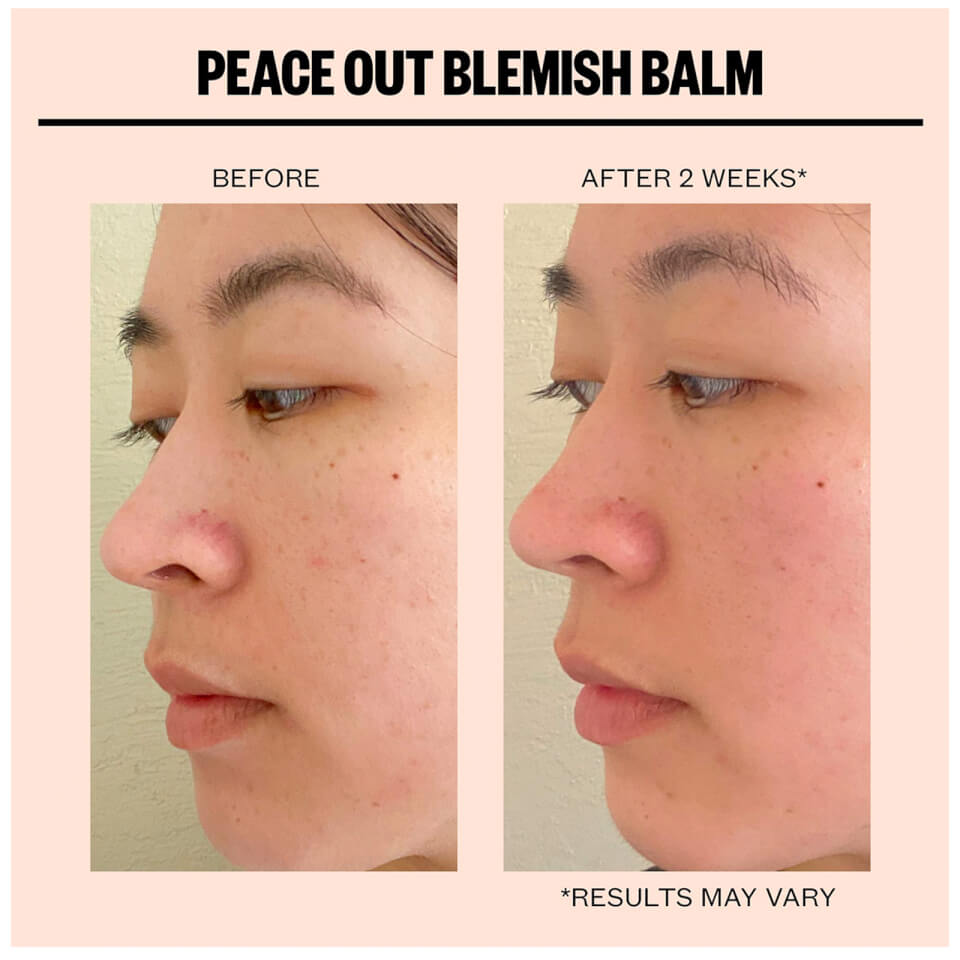 Blemish balm hotsell