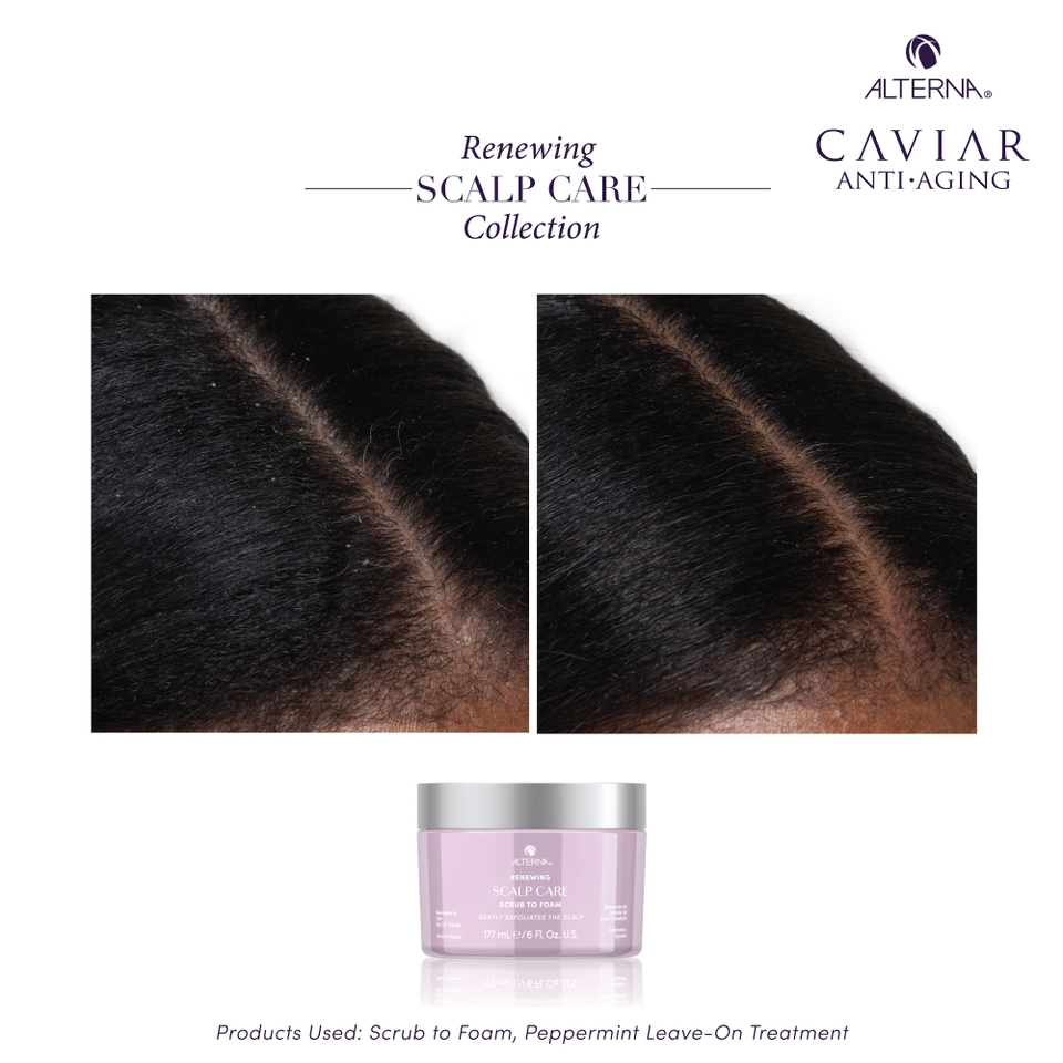 Alterna Renewing Scalp Care Peppermint Treat 2oz