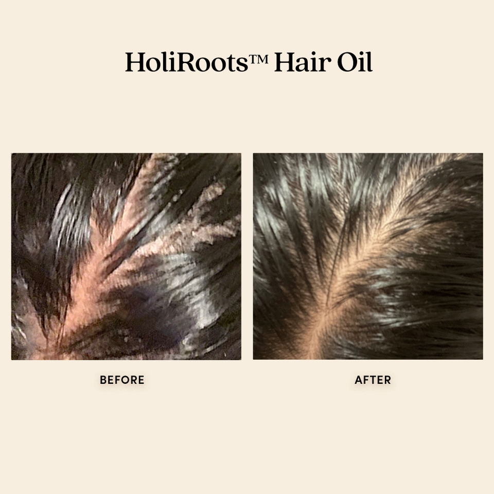 Fable & Mane HoliRoots Pre-Wash Strengthening Treatment Hair Oil 100ml