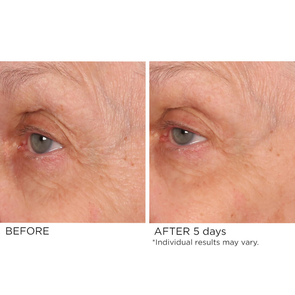 NassifMD Dermaceuticals Age Defying Eye Renewal Serum 15ml