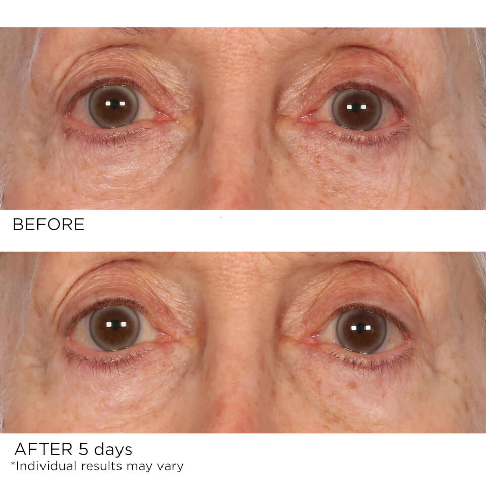 NassifMD Dermaceuticals Age Defying Eye Renewal Serum 15ml
