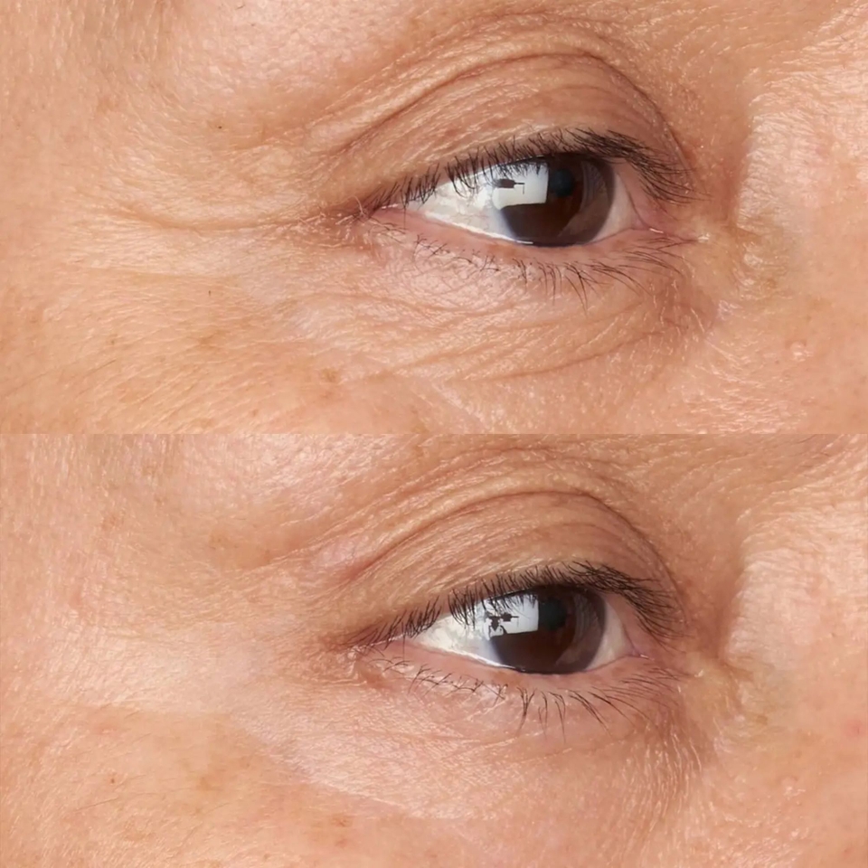 Perricone MD FG Sensitive Skin Eye Cream 0.5 oz