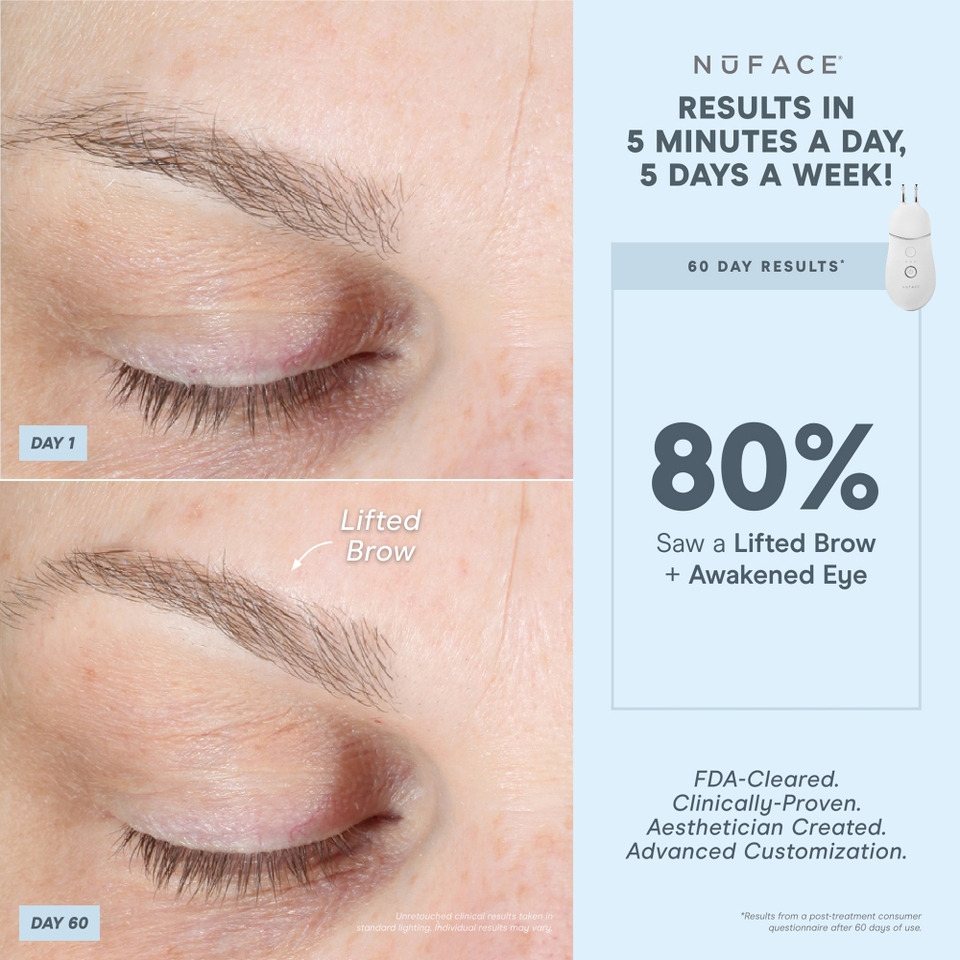 NuFACE TRINITY+® Effective Lip & Eye Attachment
