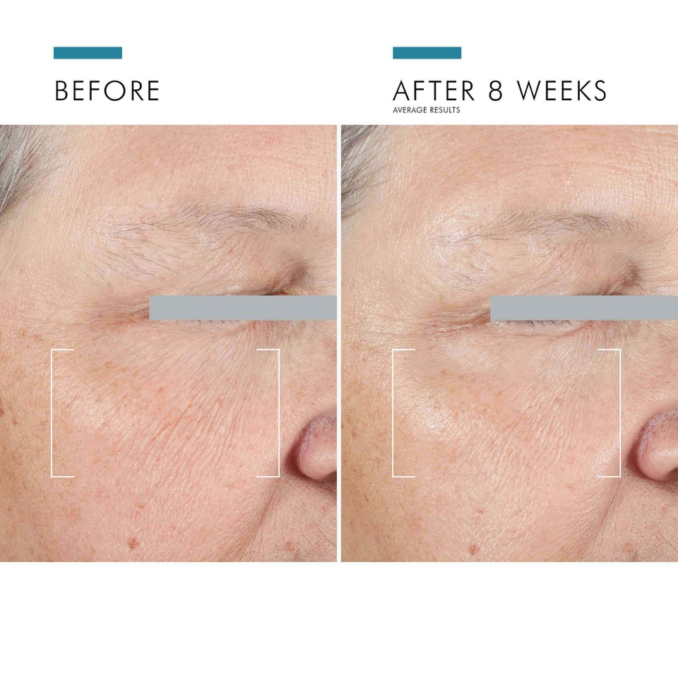 A.G.E. Interrupter Advanced Anti-Wrinkle Face Cream