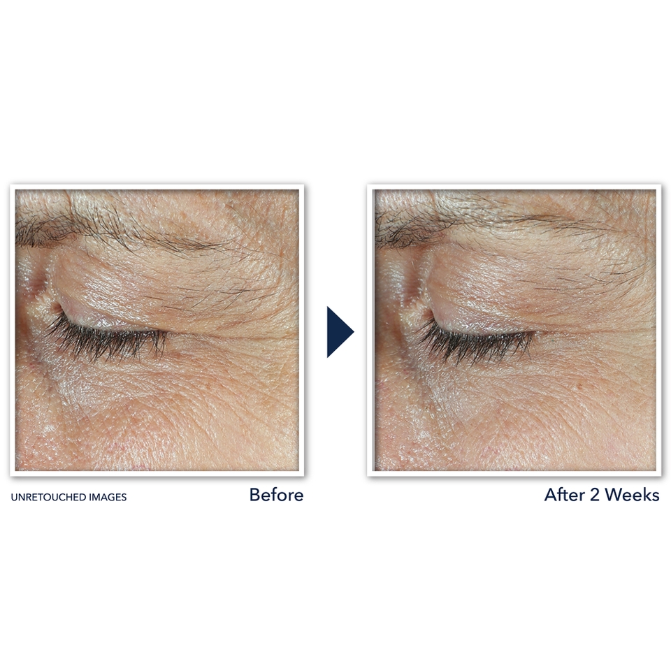 RoC Skincare Derm Correxion Dual Eye Cream 2 x 10ml
