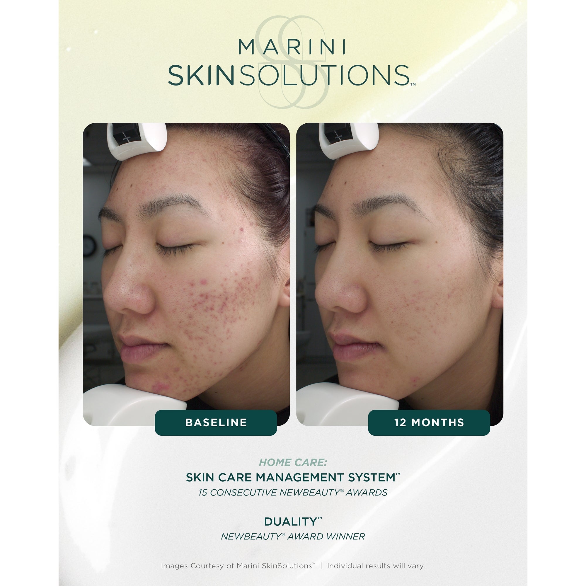 Jan Marini SkinSolutions Duality (1fl. Oz.) | Dermstore