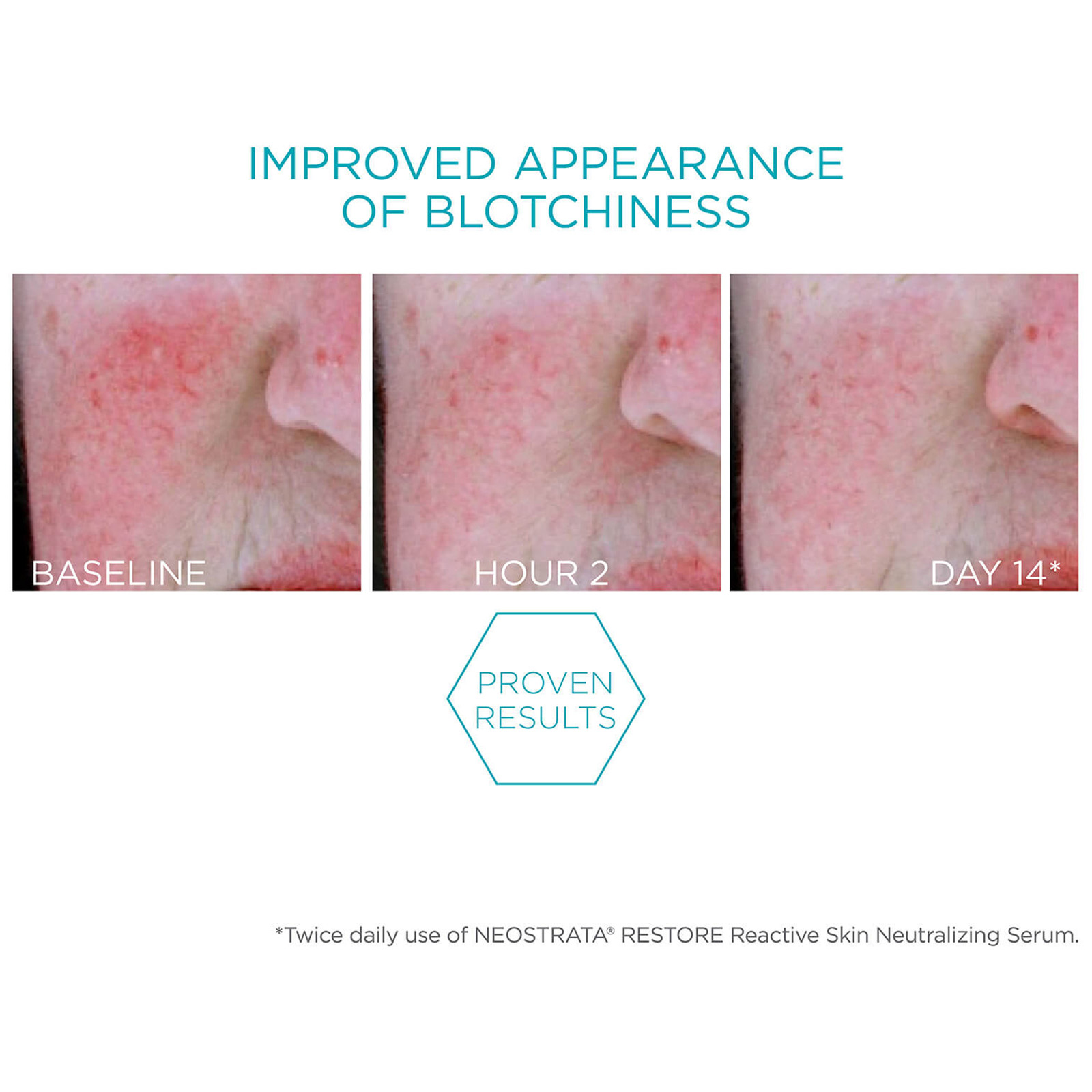 NEOSTRATA Restore Redness Neutralising Serum for Sensitive Skin