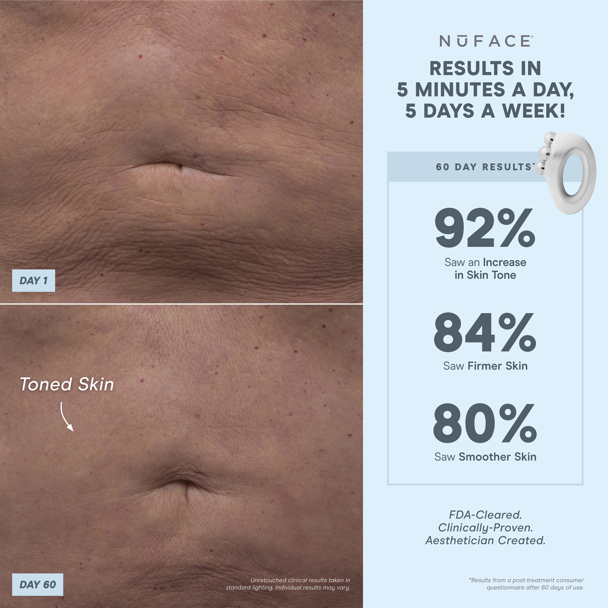 NuBODY Skin Toning Device | Dermstore