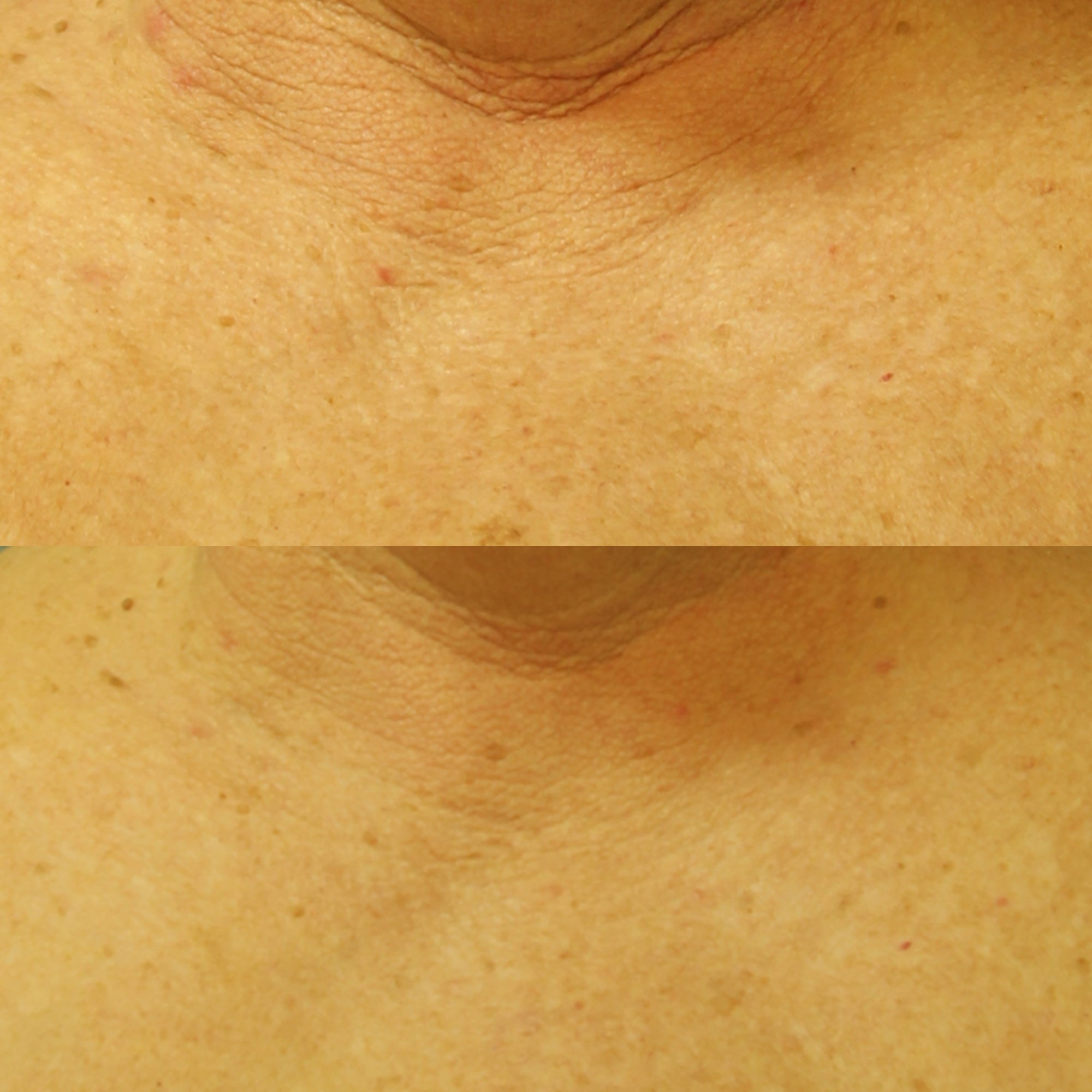 Neuropeptide Restorative Neck & Chest Therapy Broad Spectrum SPF