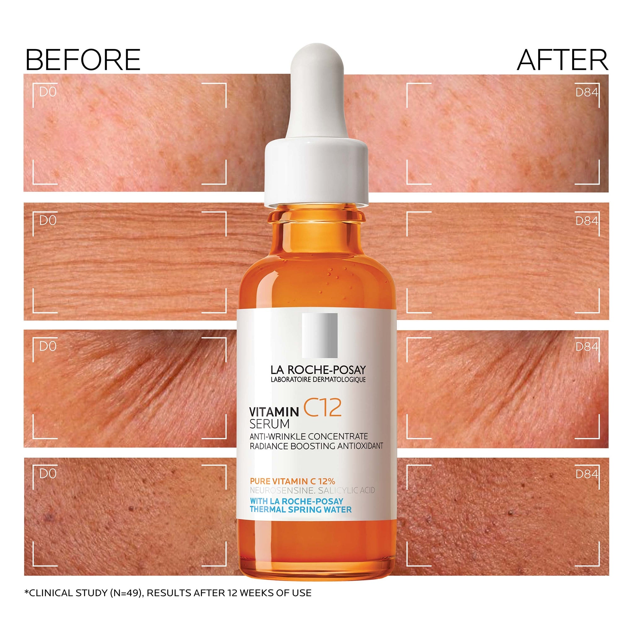 La Roche-Posay 12% Pure Vitamin C Serum (1 fl. oz.) | Dermstore