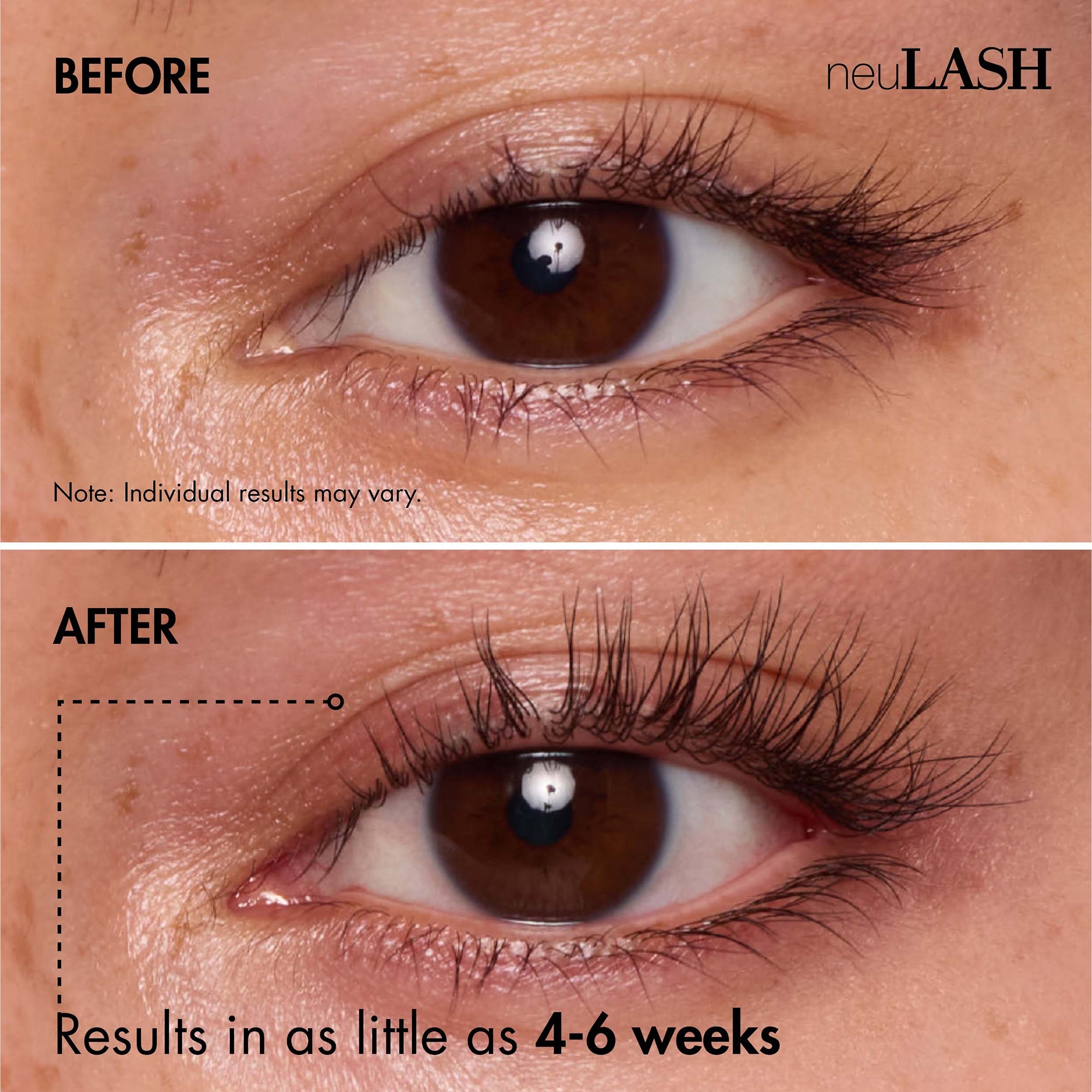neuLash neuLASH Lash Enhancing Serum (0.11 fl. oz.) | Dermstore