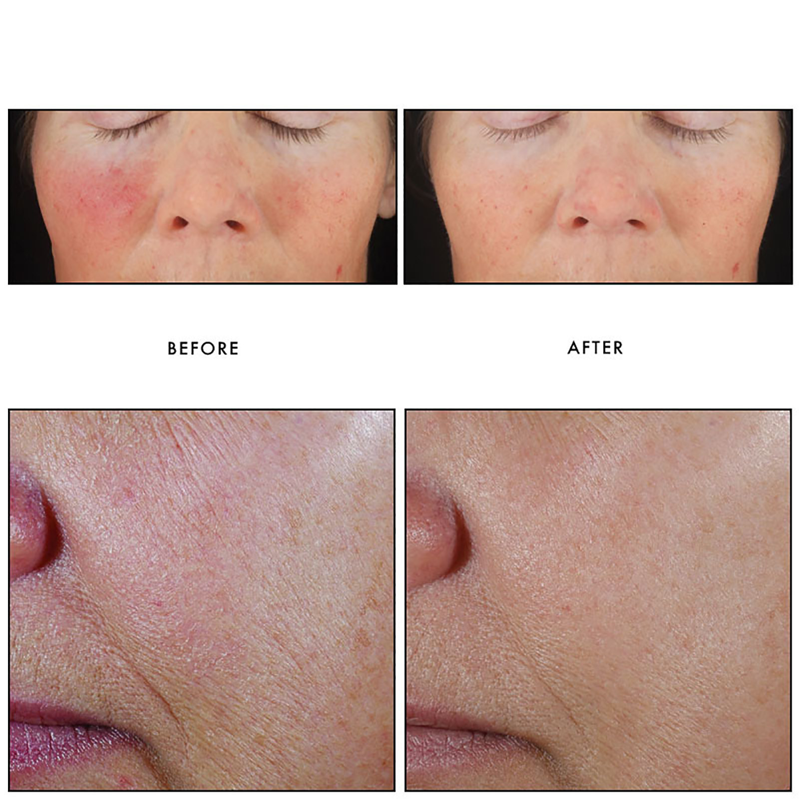 【サヤ 】C+ Correcting Complex 30% 2本セット サヤ 】C+ Correcting Complex 30% 2本セット サヤ 】C+ Correcting