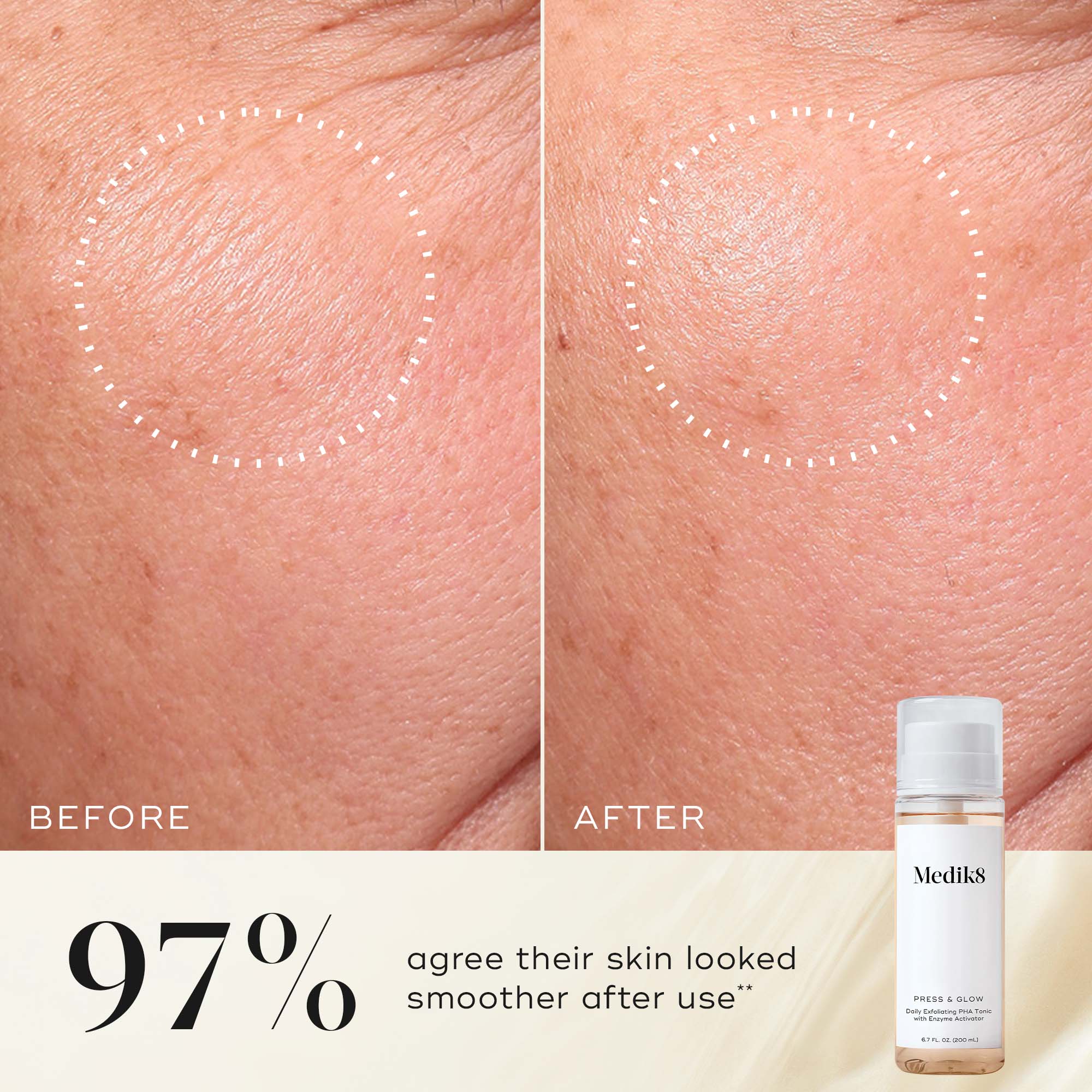Medik8 press and glow discount