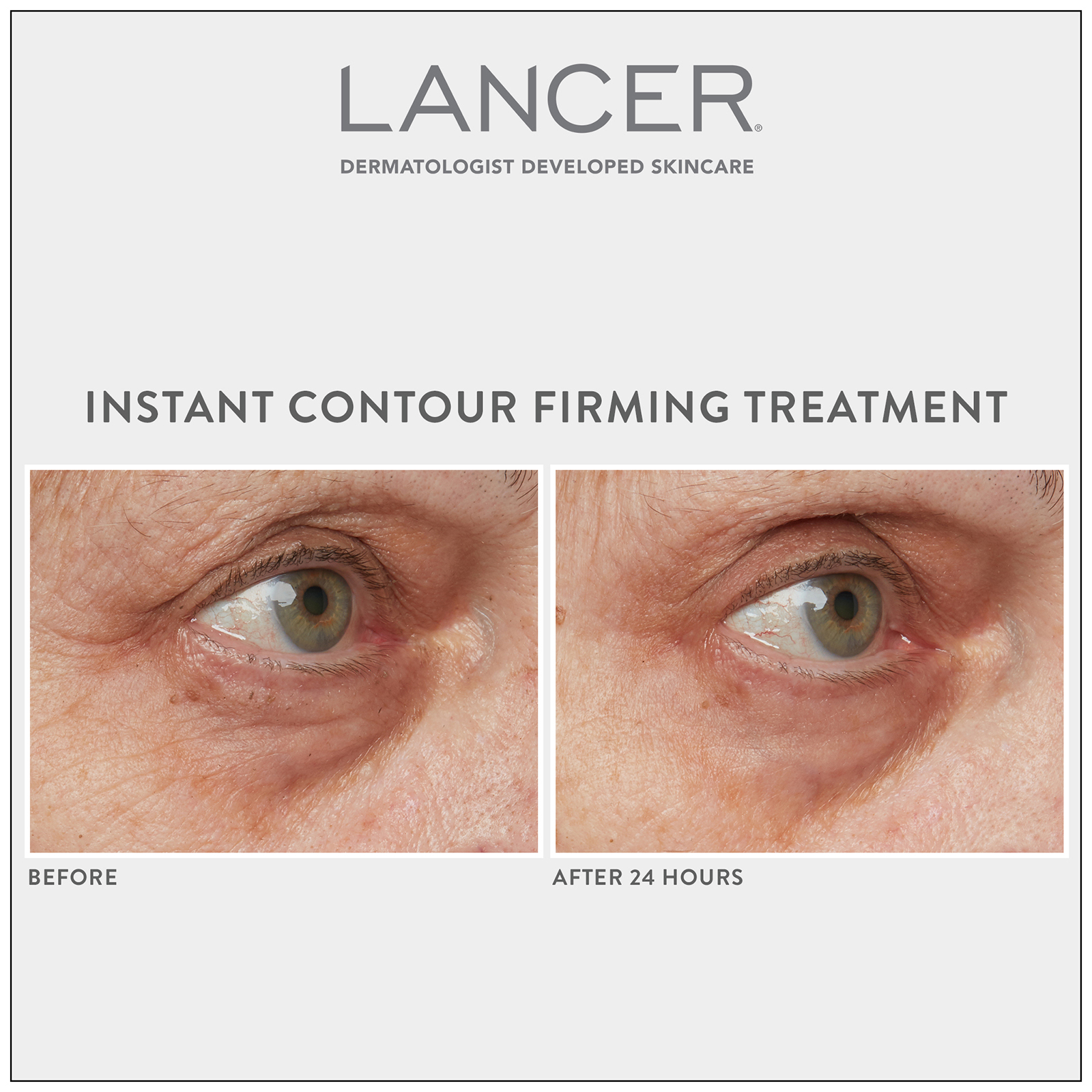 Lancer Instant Countour hotsell Firming Treatment NEW WITH BOX PLUS GIFT