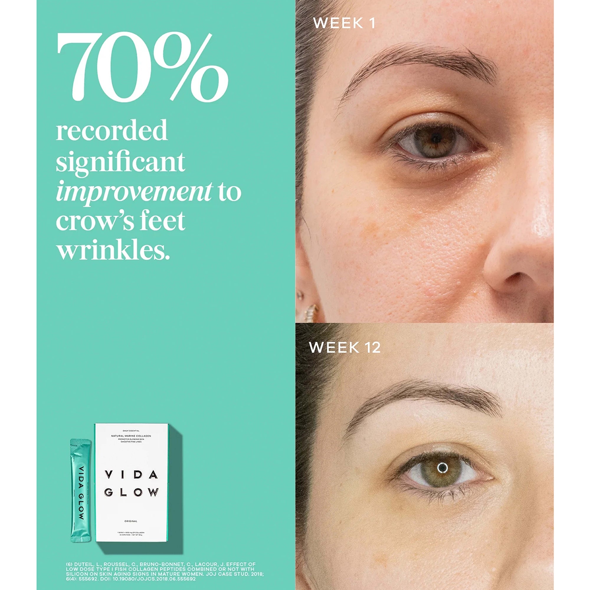 Vida Glow Natural Marine Collagen Sachets - Original | Cult Beauty
