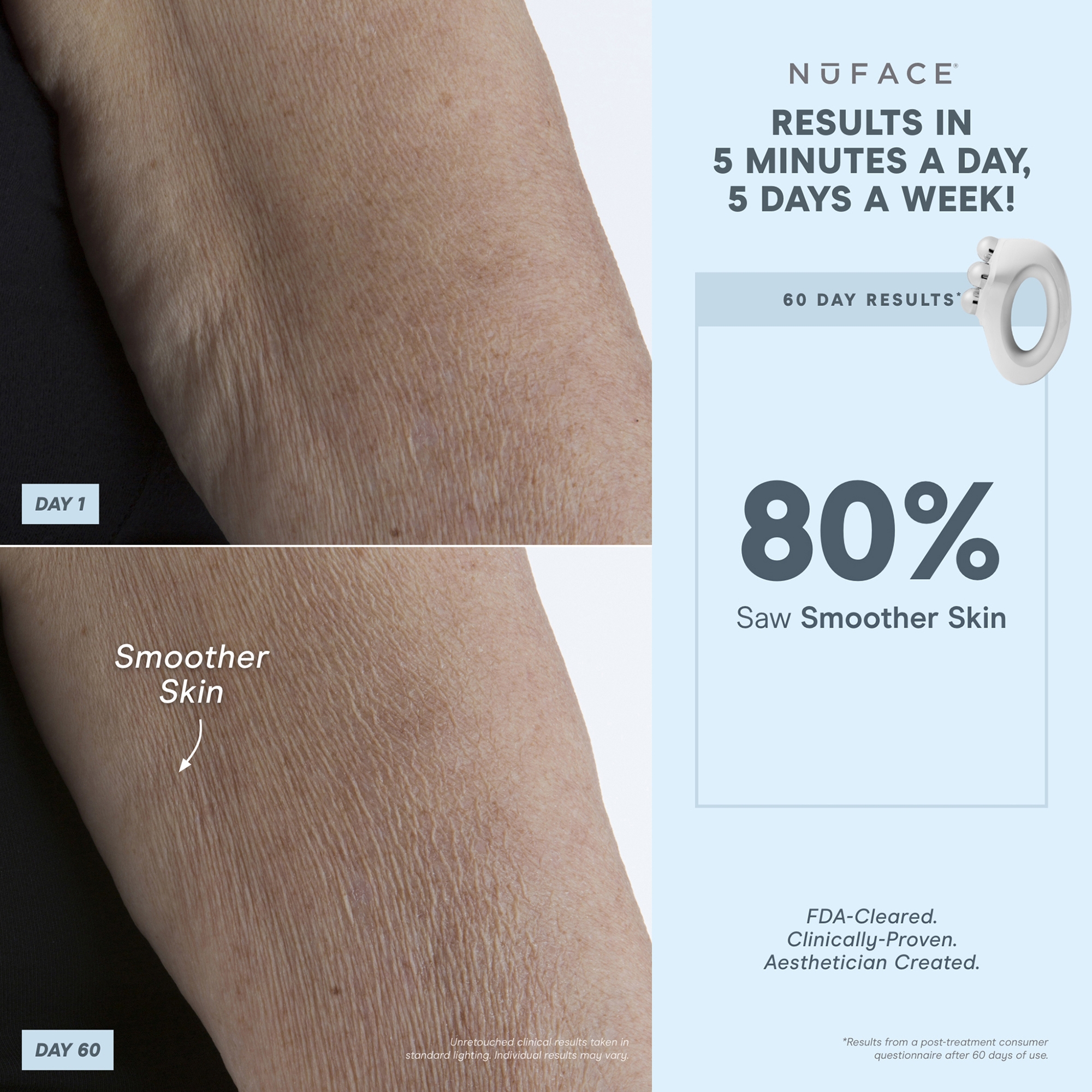 ボディ・フェイスケア SILVER REED GESKE フェイシャル ハイドレーション リフレッシャー ハンディ