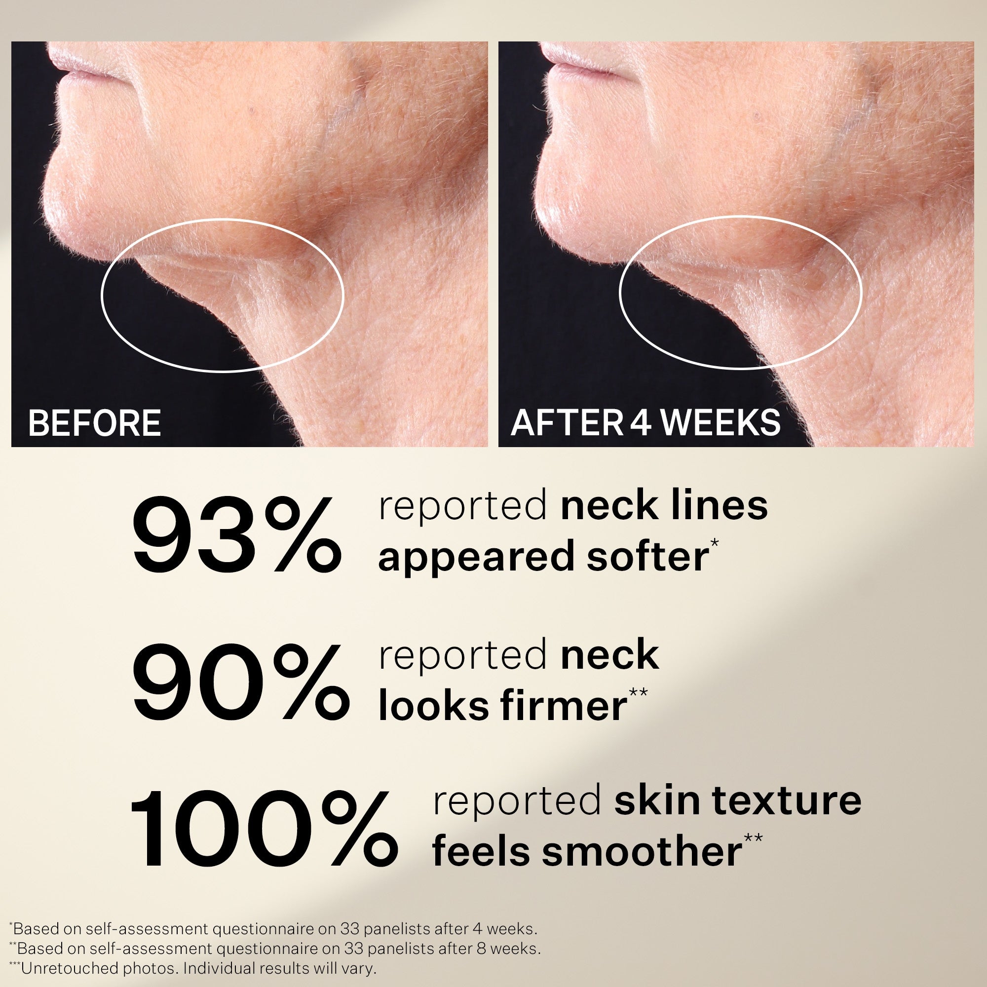 StriVectin Peptight Tightening Neck Serum Roller | Dermstore