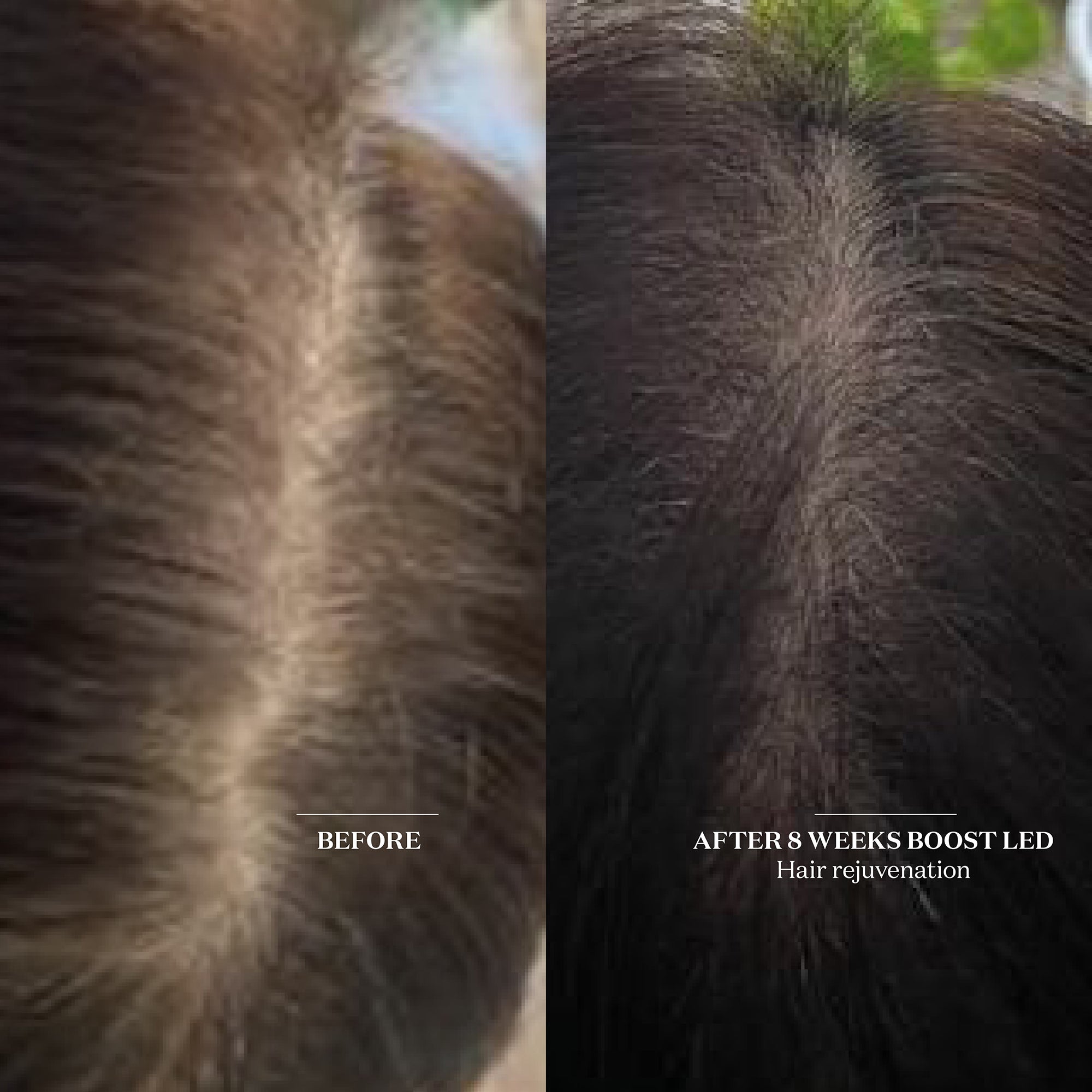 The Light Salon Boost LED Patch | Dermstore