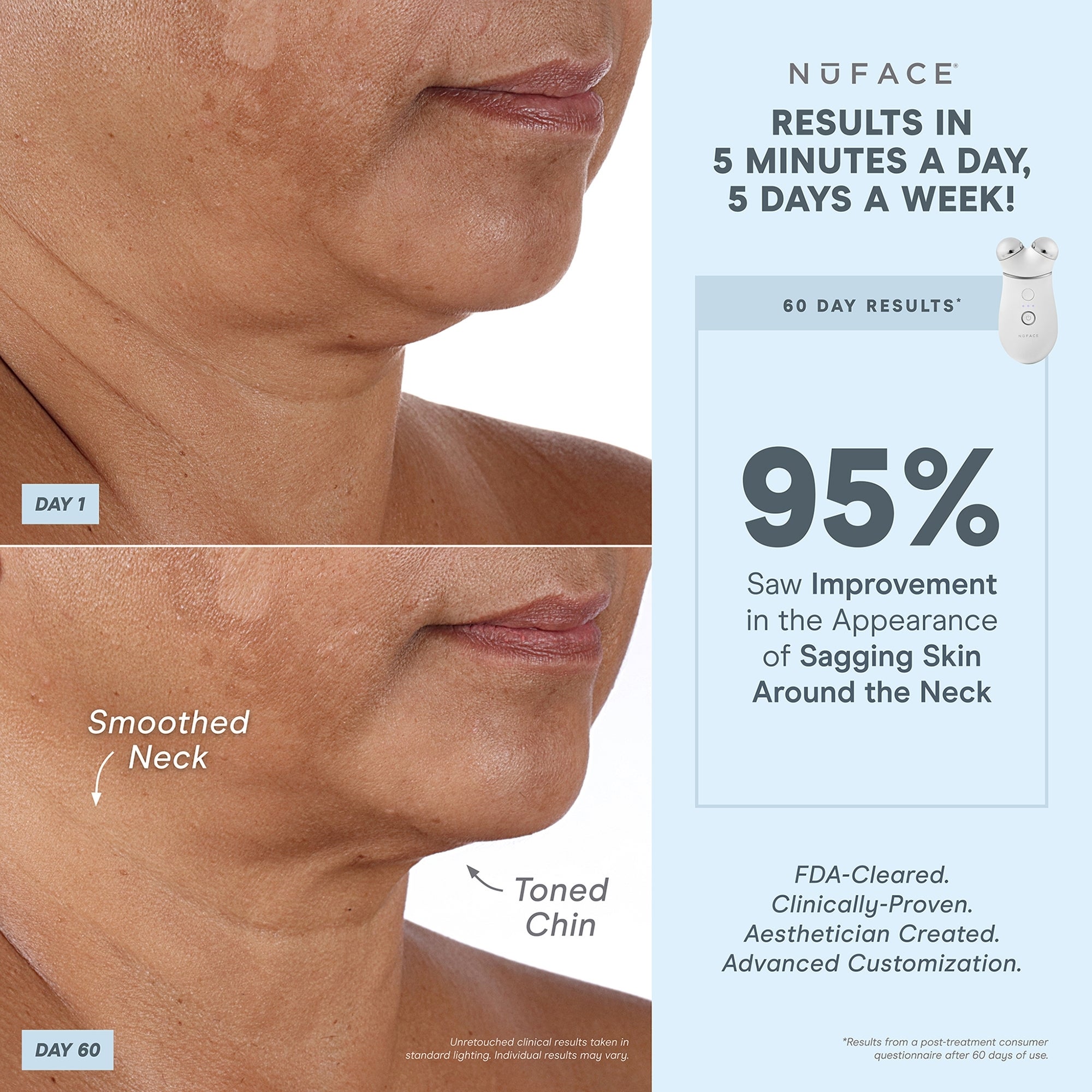 NuFACE Trinity+ Red Light and Wrinkle Reducer Attachment Set