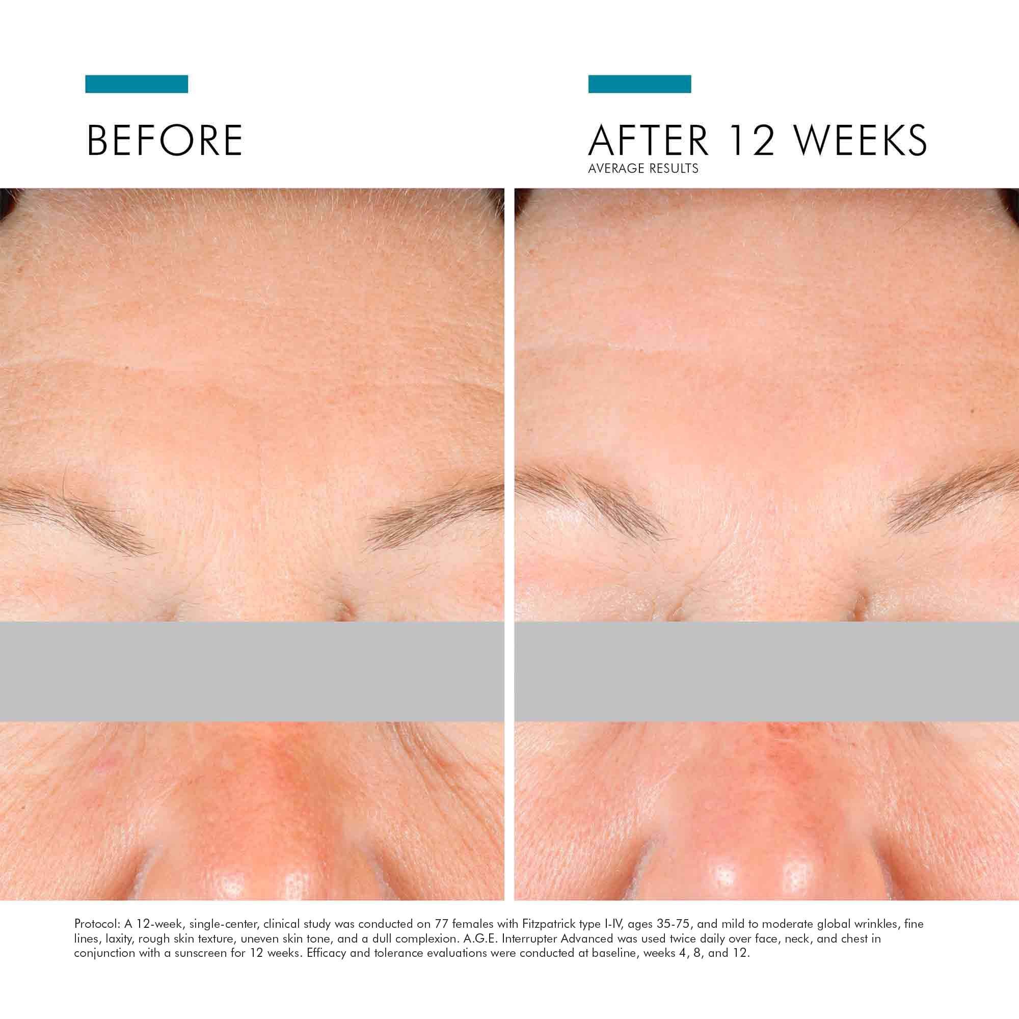 SkinCeuticals A.G.E. Interrupter Advanced Anti-Wrinkle Cream (1.7