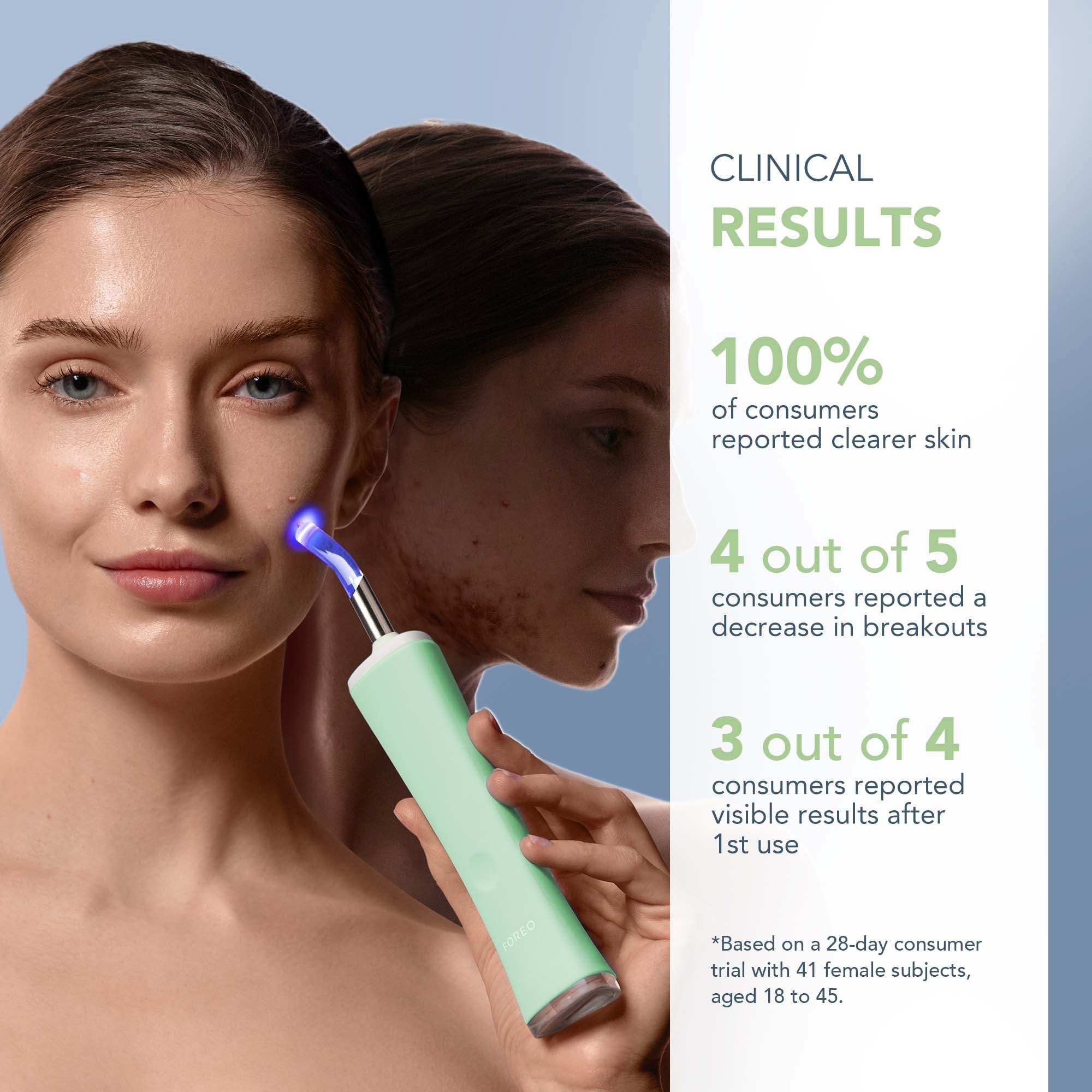 FOREO ESPADA 2 plus Device - Lavender | Cult Beauty
