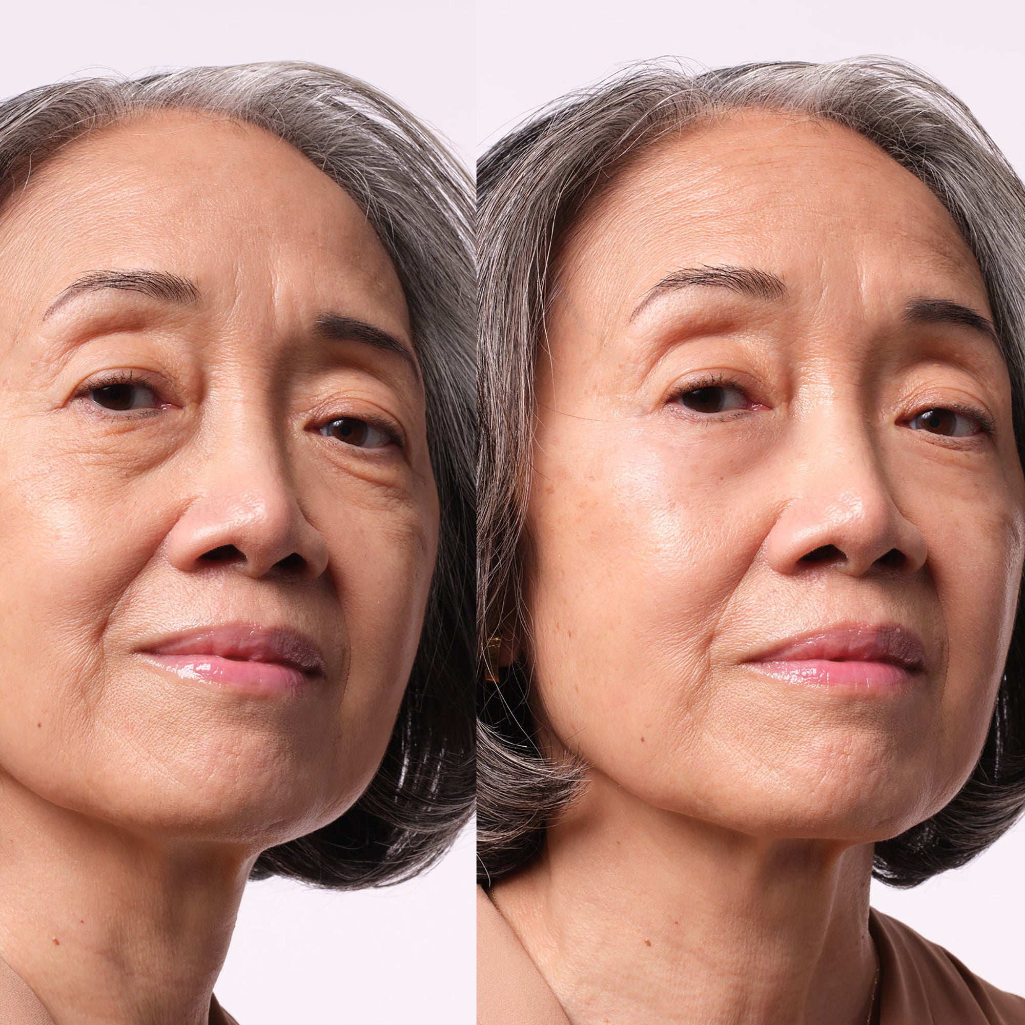 Atashi Augenserum Gegen Tränensäcke & Dunkle Ringe – Mit Haloxyl, 15 Ml, Sofortiger Effekt