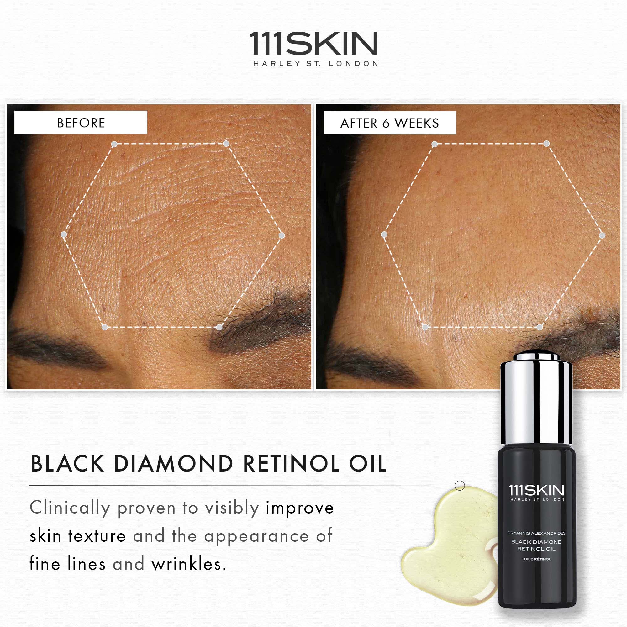 美容液 111SKIN  RETINOL OIL 30mL 14889268-1815172948535551.jpg