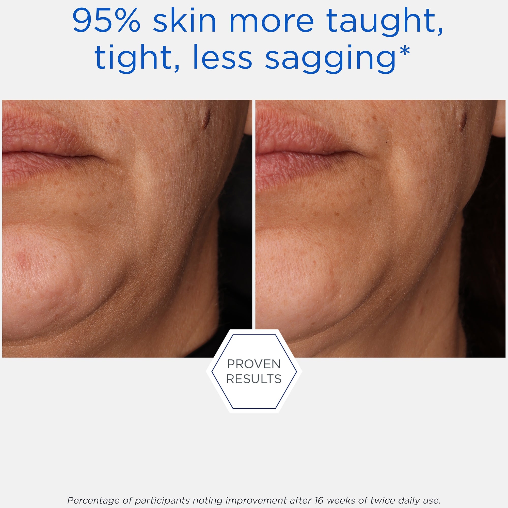 Neostrata Skin Active Tri-Therapy Lifting Serum New and Improved