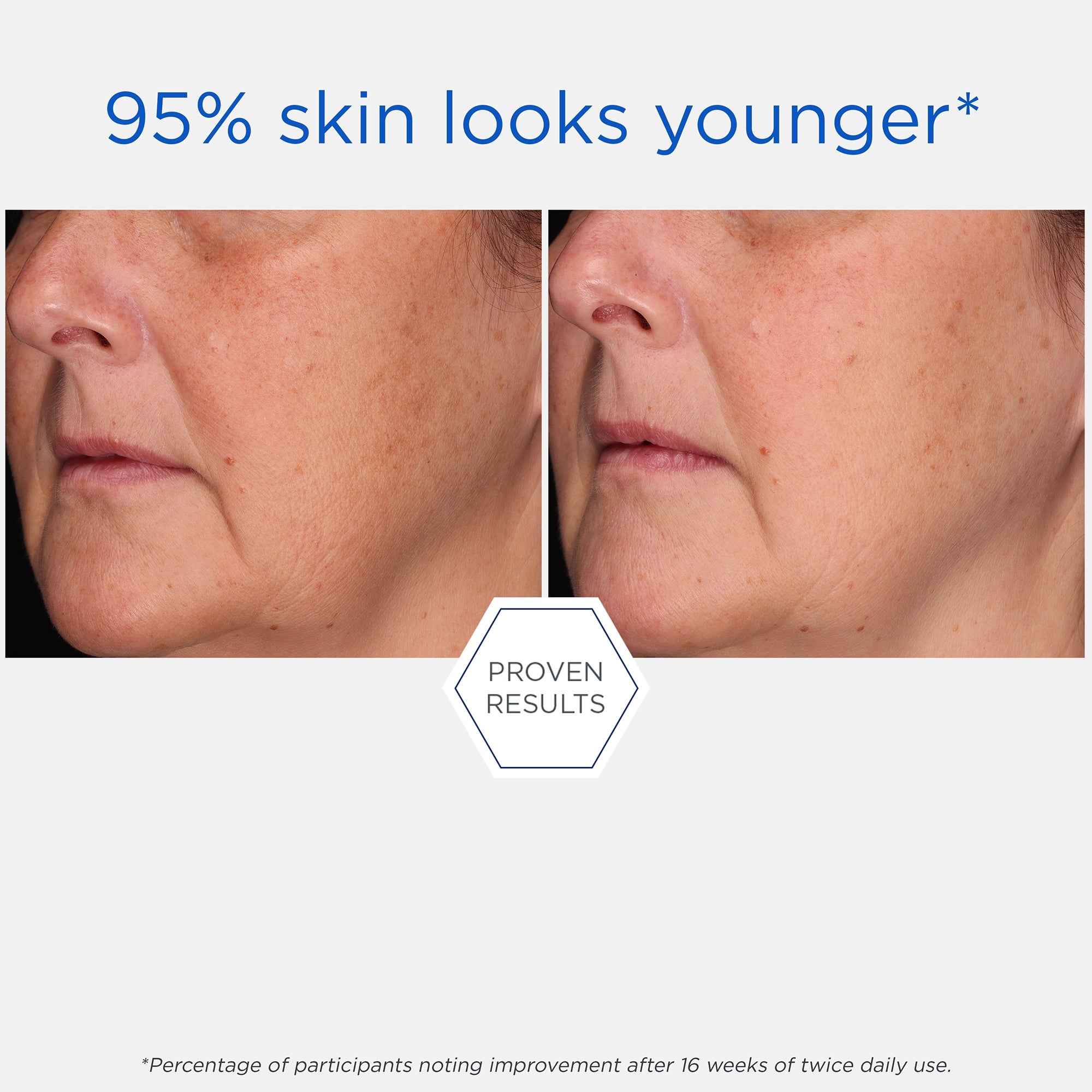 Neostrata Skin Active Tri-Therapy Lifting Serum New and Improved
