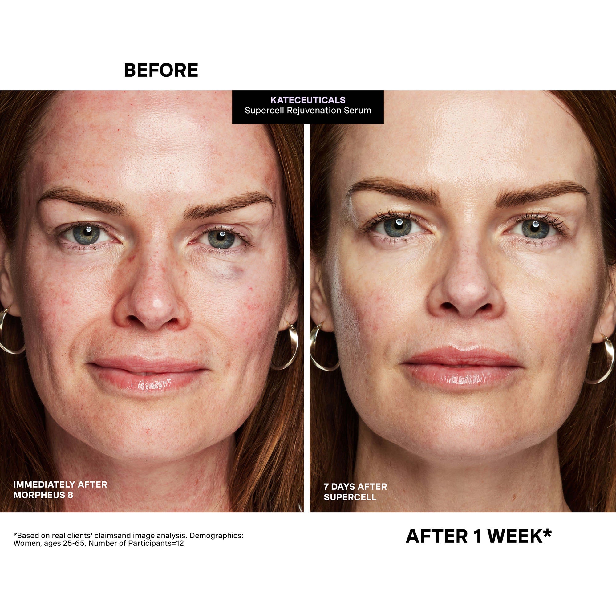 Kate Somerville KateCeuticals SuperCell Rejuvenation Serum 30ml 