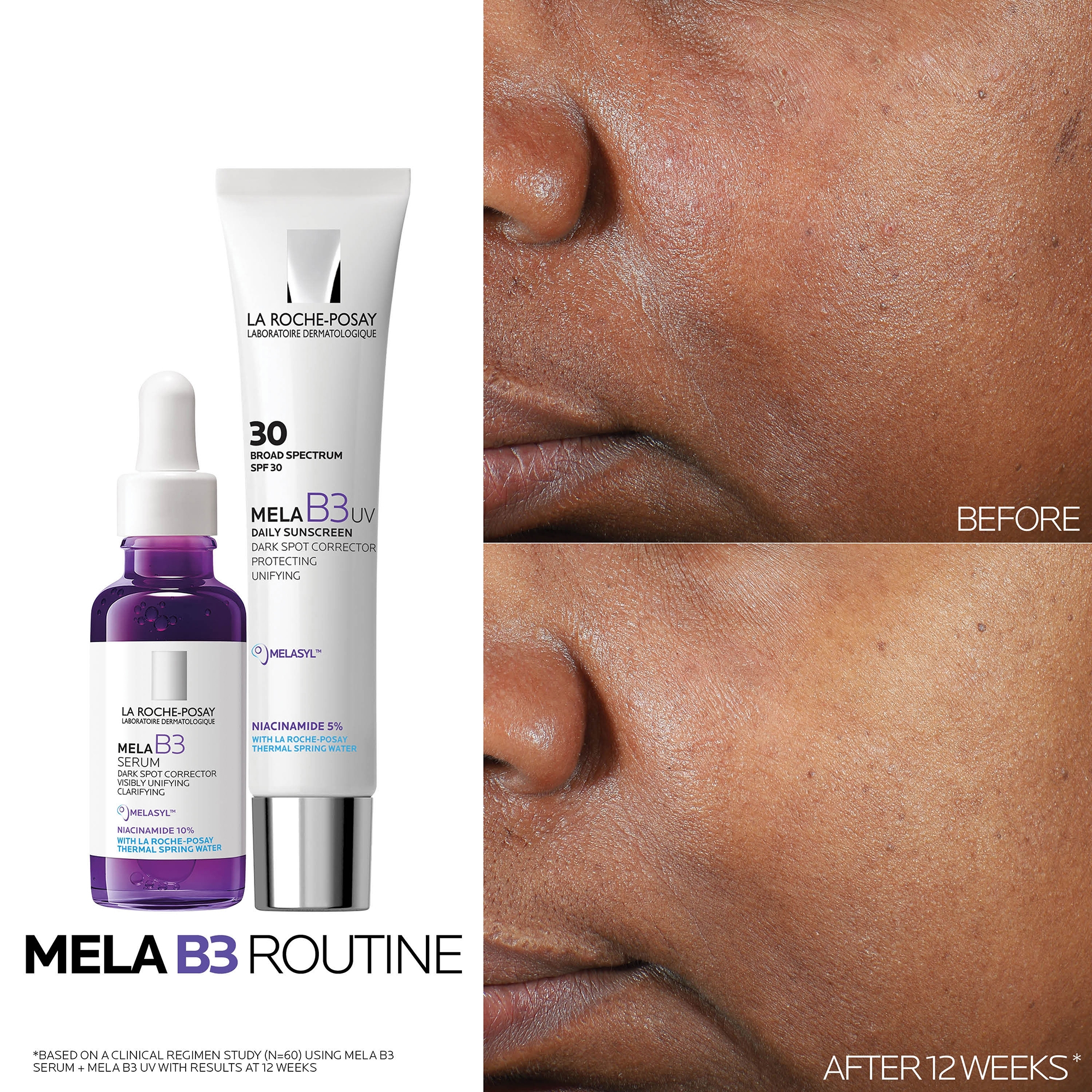 La Roche-Posay Mela B3 Dark Spot Serum With Melasyl™ and
