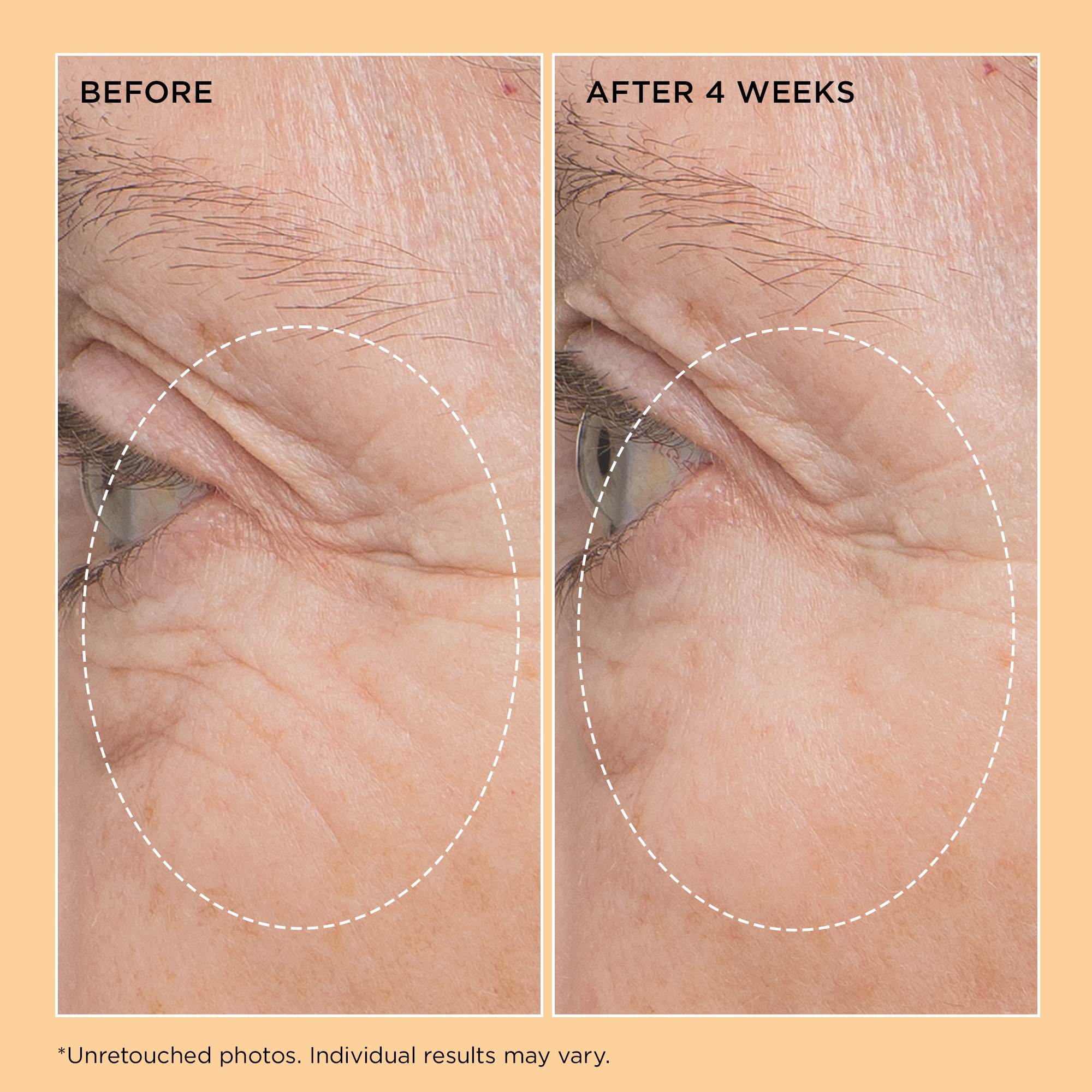 Neuropeptide Firming Facial Concentrate | Perricone MD