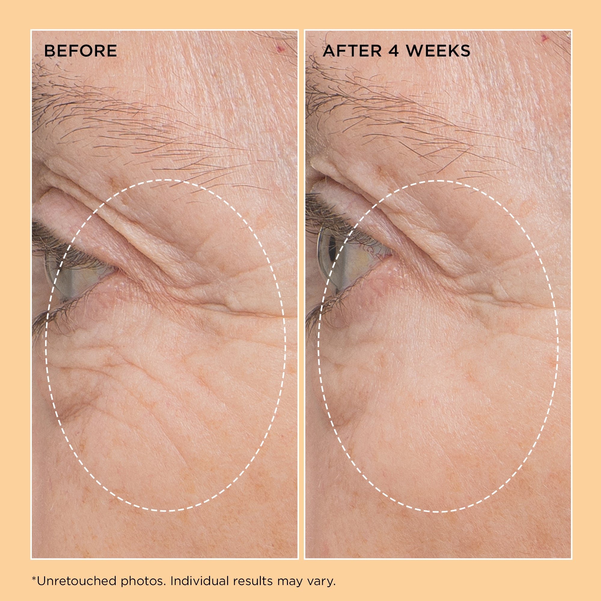 Neuropeptide Firming Facial Concentrate | Perricone MD