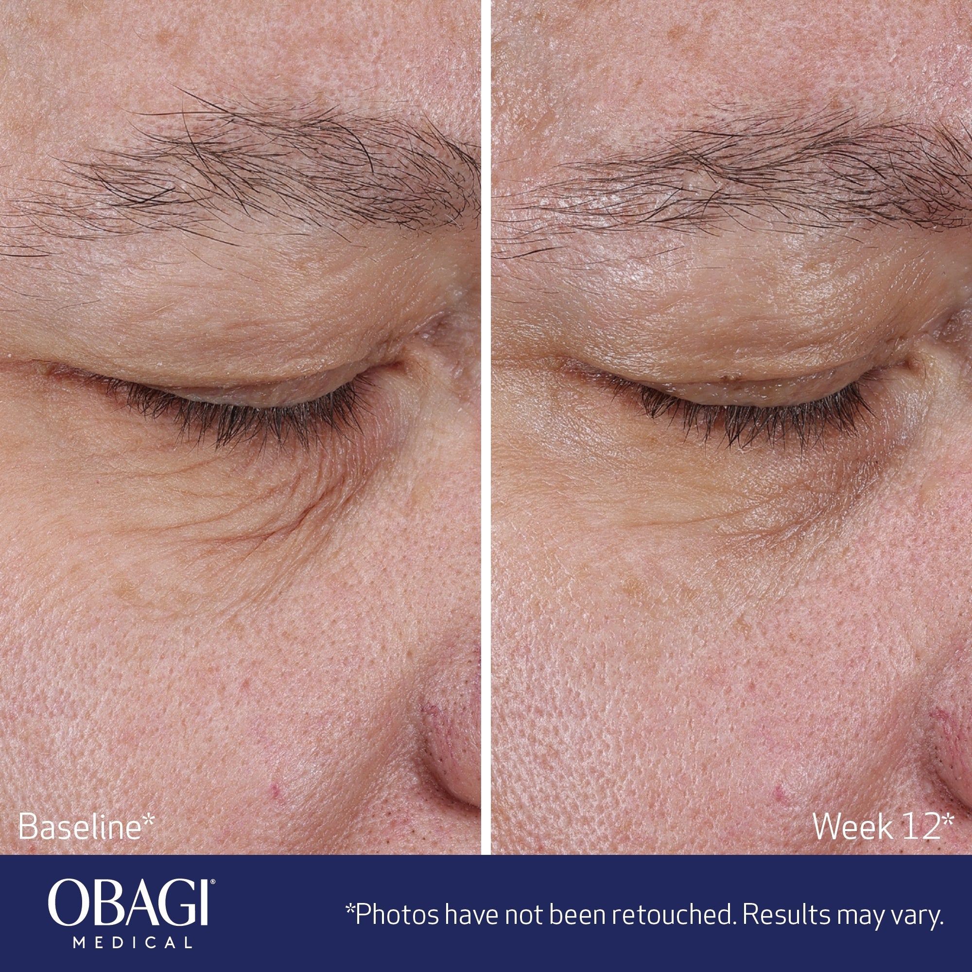 Obagi Medical ELASTIderm Lift Up and Sculpt Facial Moisturizer