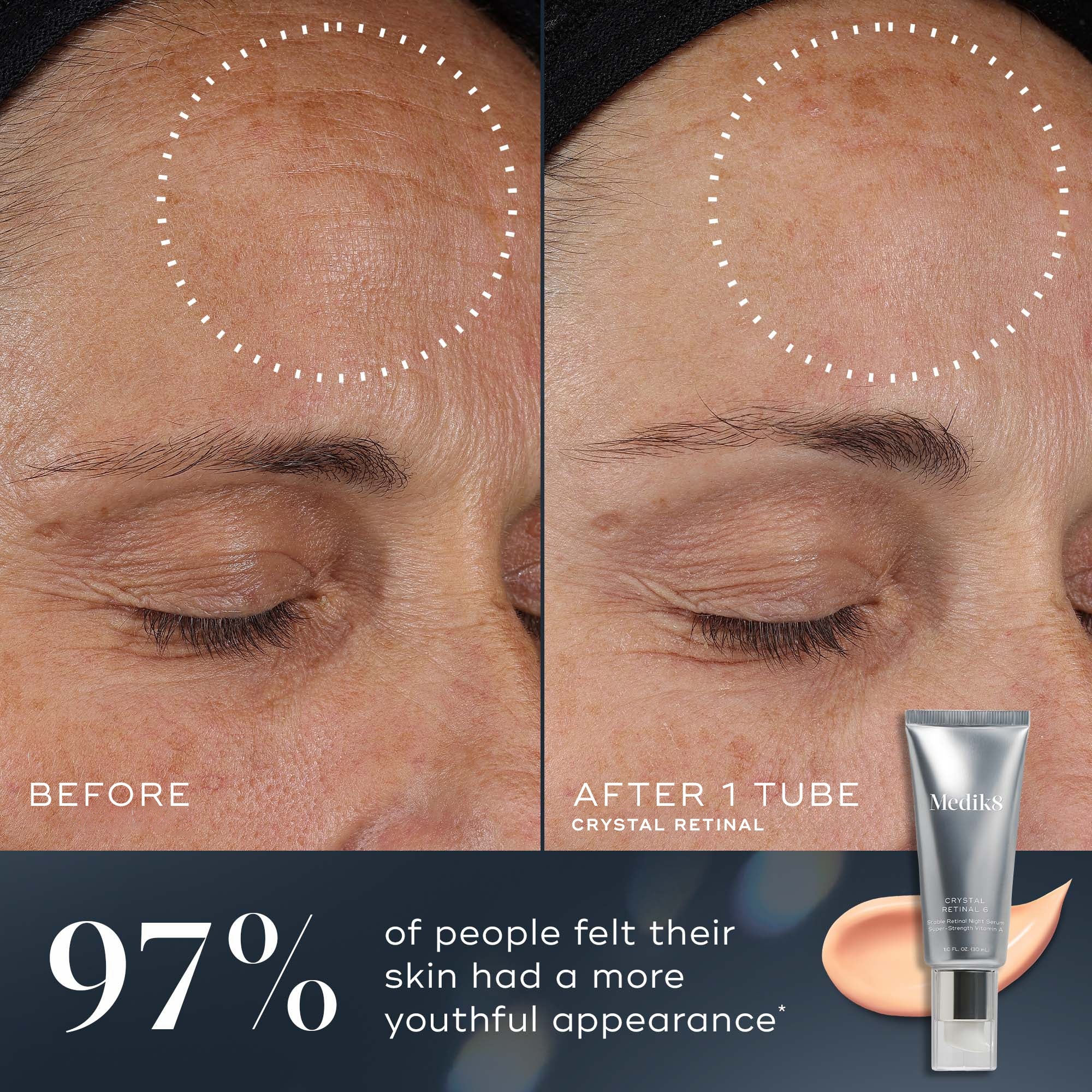 Medik8 Nighttime Renew Age-Defying Face & Eyes Collection 45ml