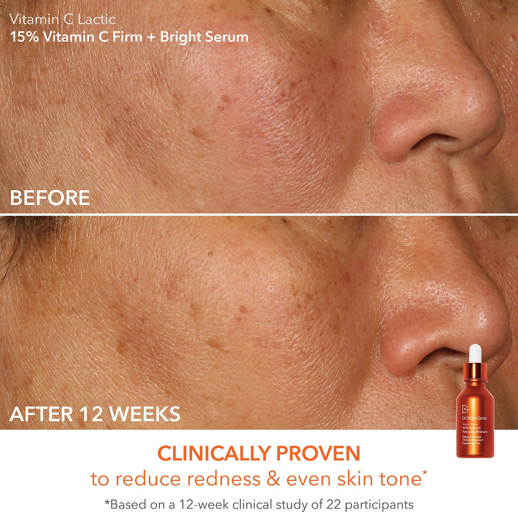 Dr Dennis Gross Skincare Bright and Tight Delights ($151 Value