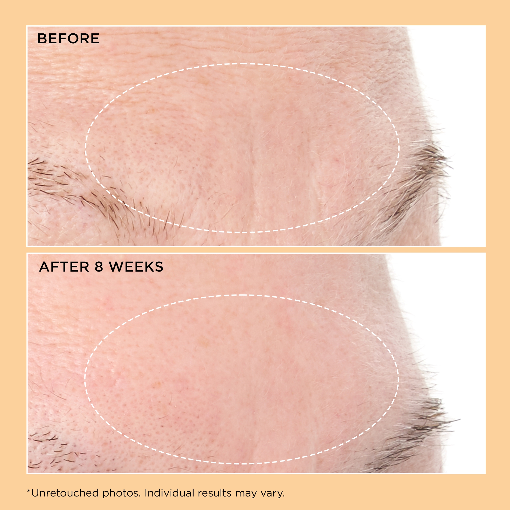 Neuropeptide Deep Crease Serum | Perricone MD