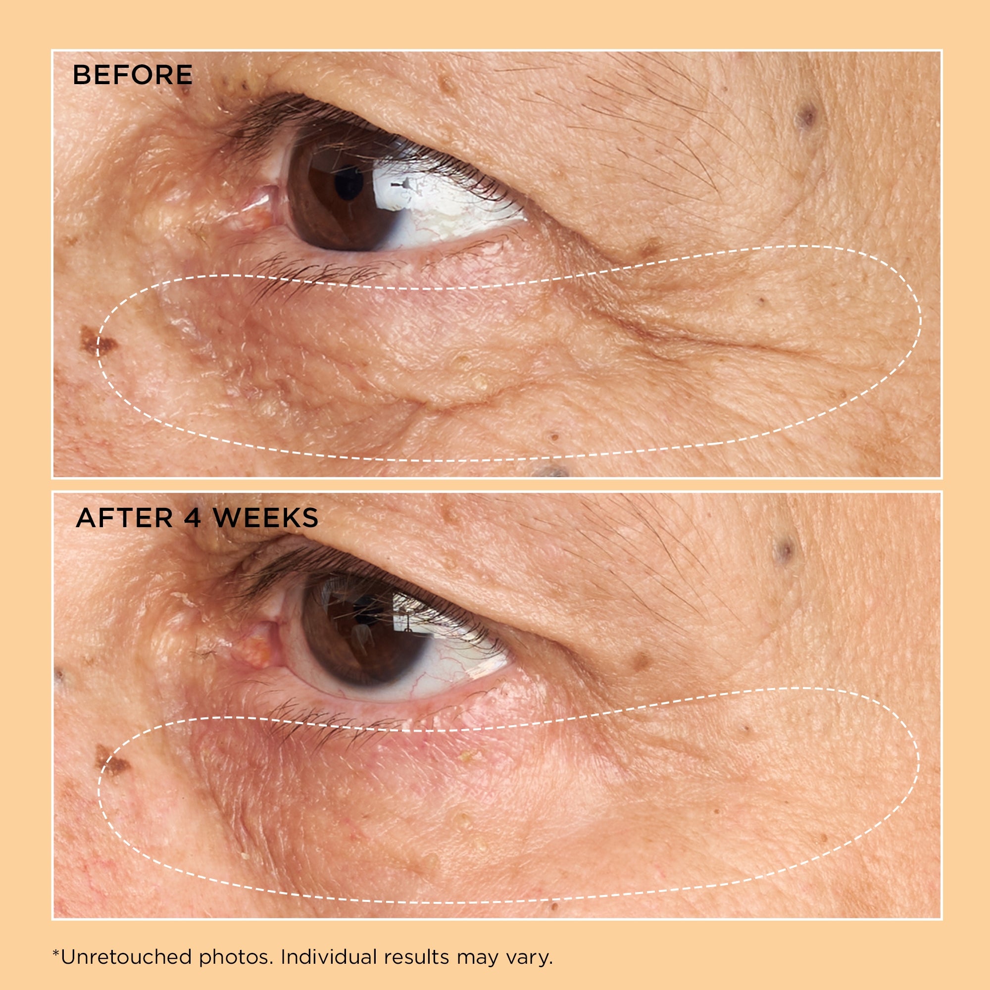 Neuropeptide Corrective Brightening Under-Eye Cream | Perricone MD