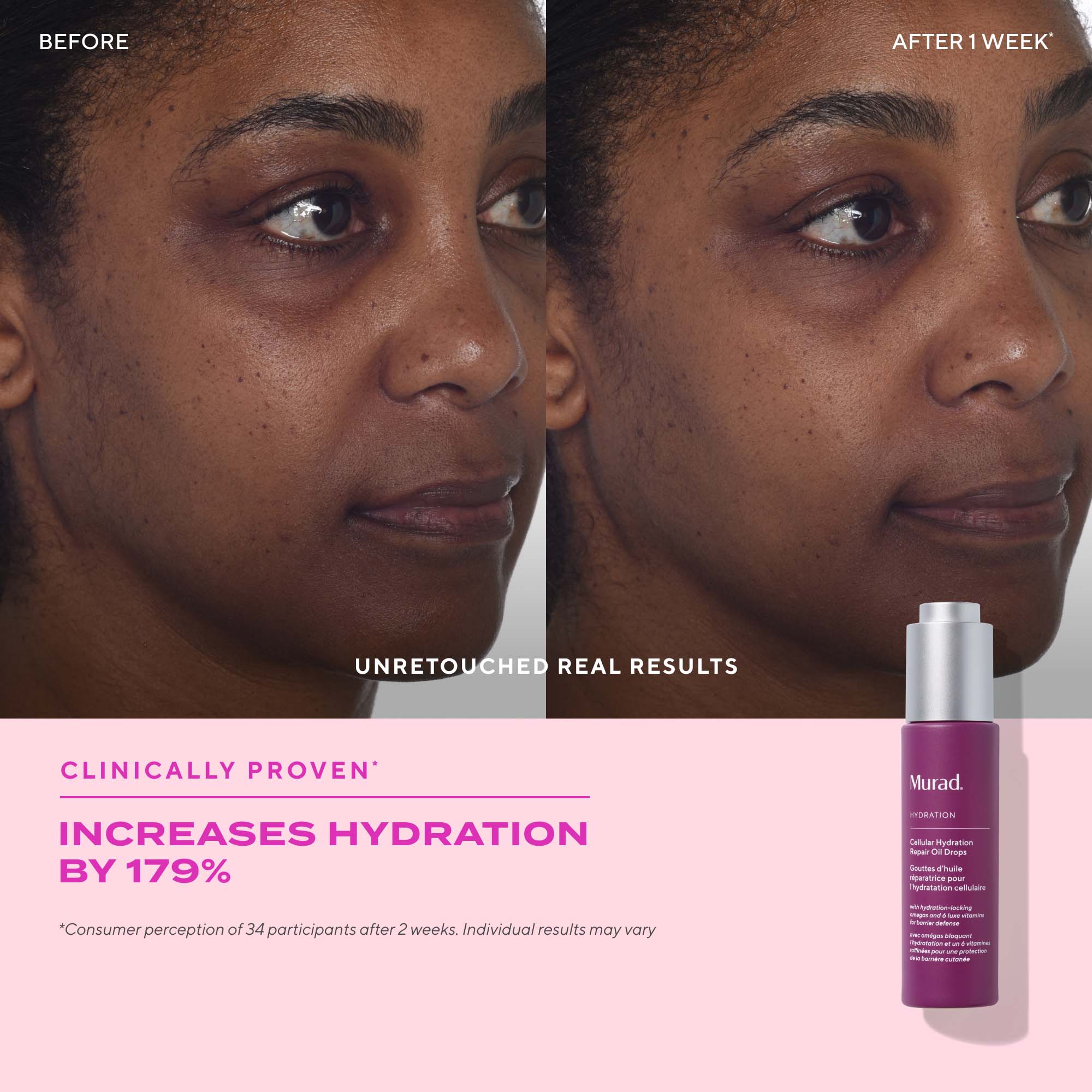 Murad Revitalixir Recovery Serum 1.35 oz | Dermstore