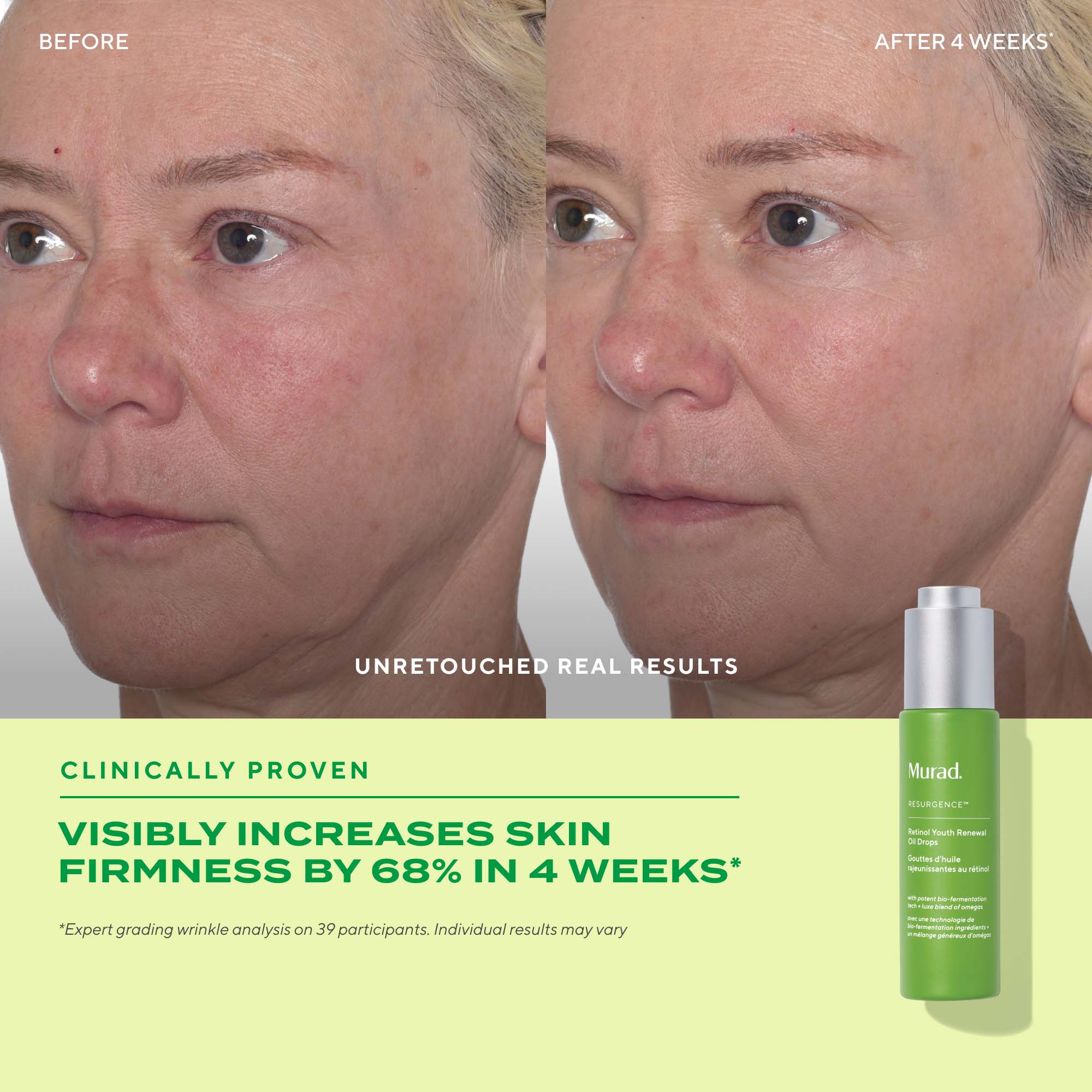 Murad Retinol Youth Renewal Oil Drops 30ml | Dermstore