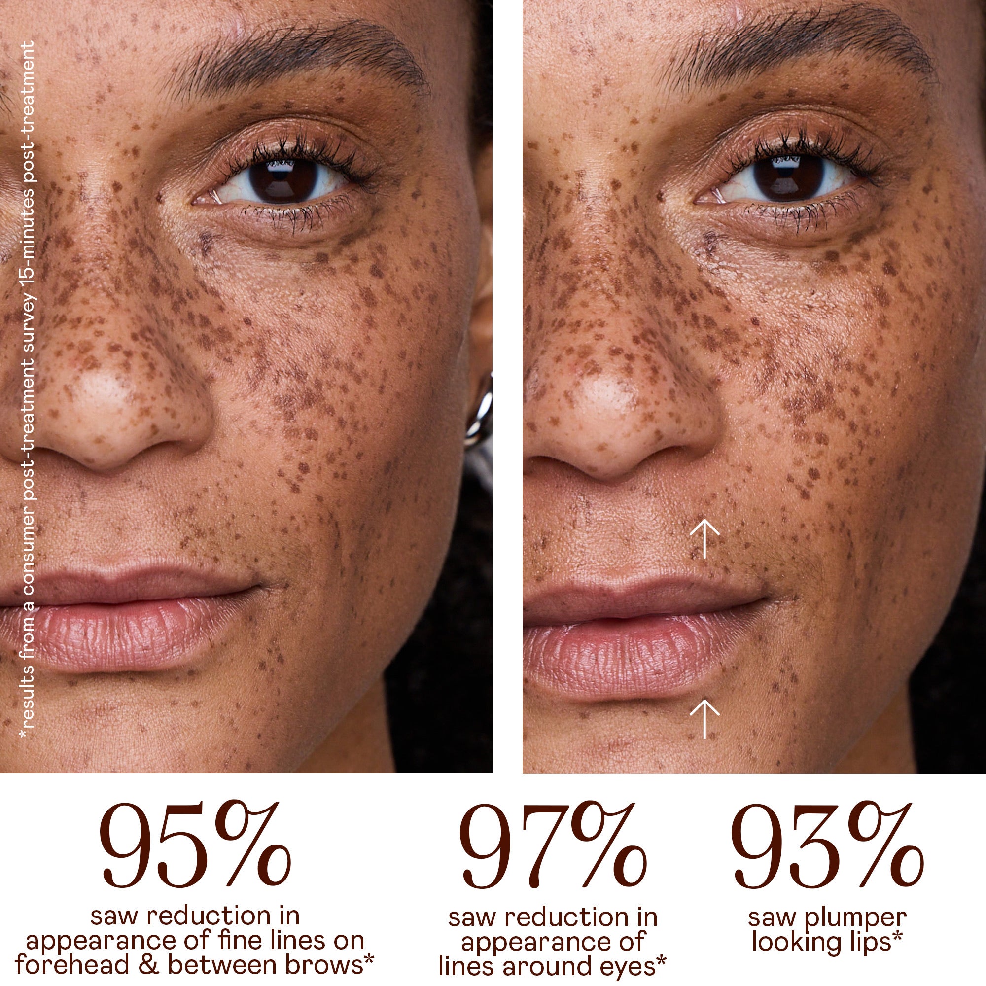 NuFACE FIX Microwand | Dermstore