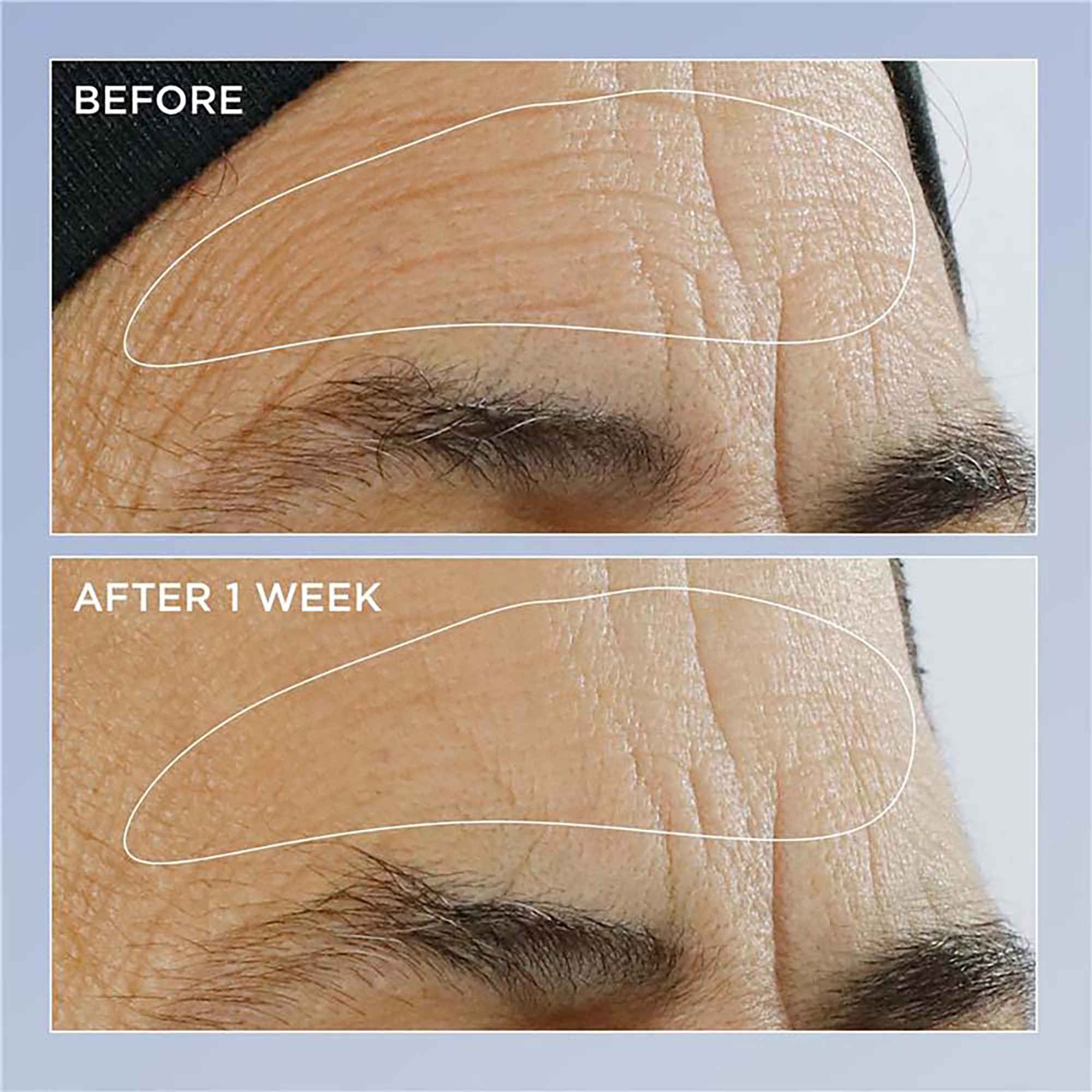 DEEP RETINOL CREAM 3本セット DEEP RETINOL CREAM 3本セット - メルカリ