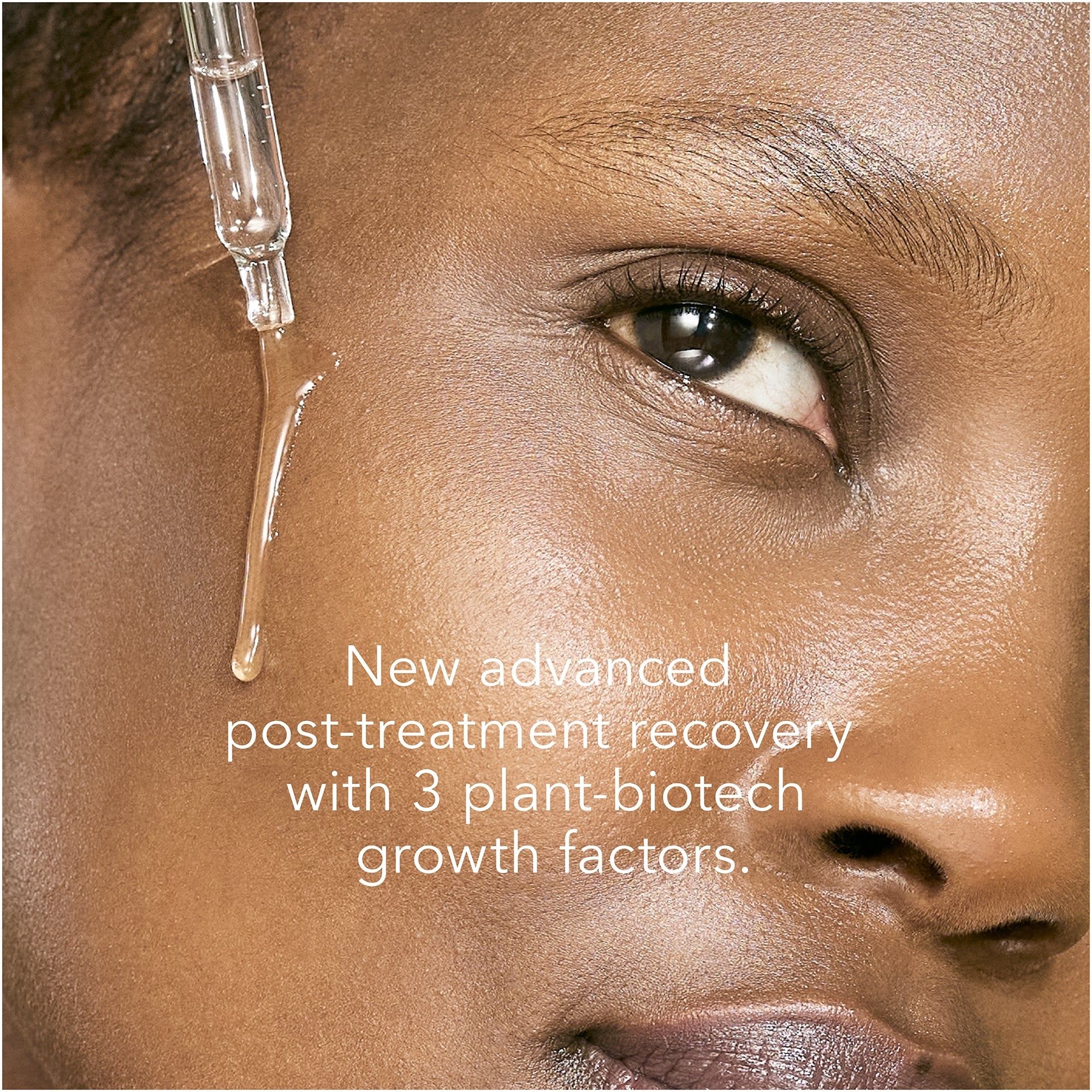 BIOEFFECT 3xGF Recovery Serum 15ml | Dermstore
