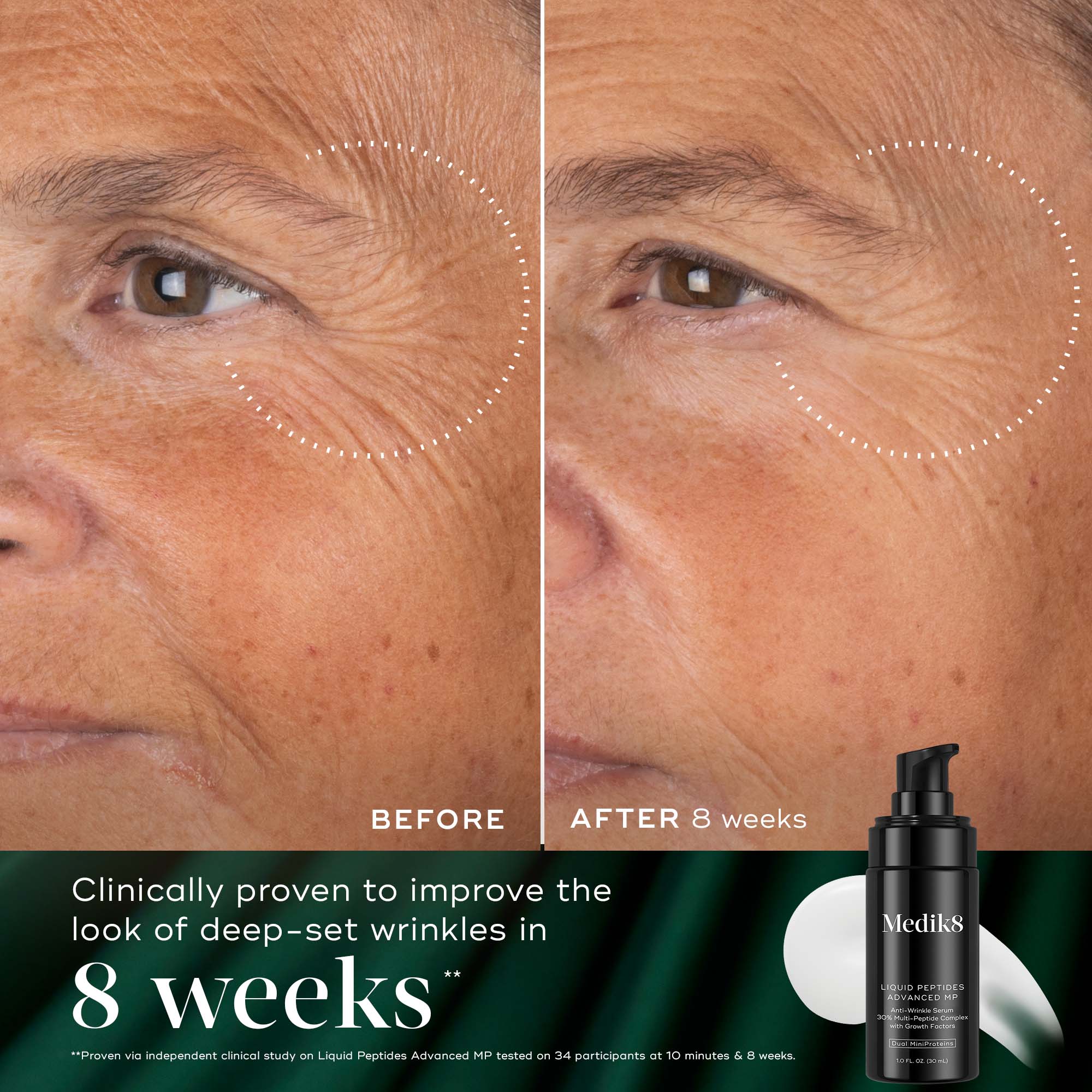 Medik8 Overnight Renewal Kit | Dermstore
