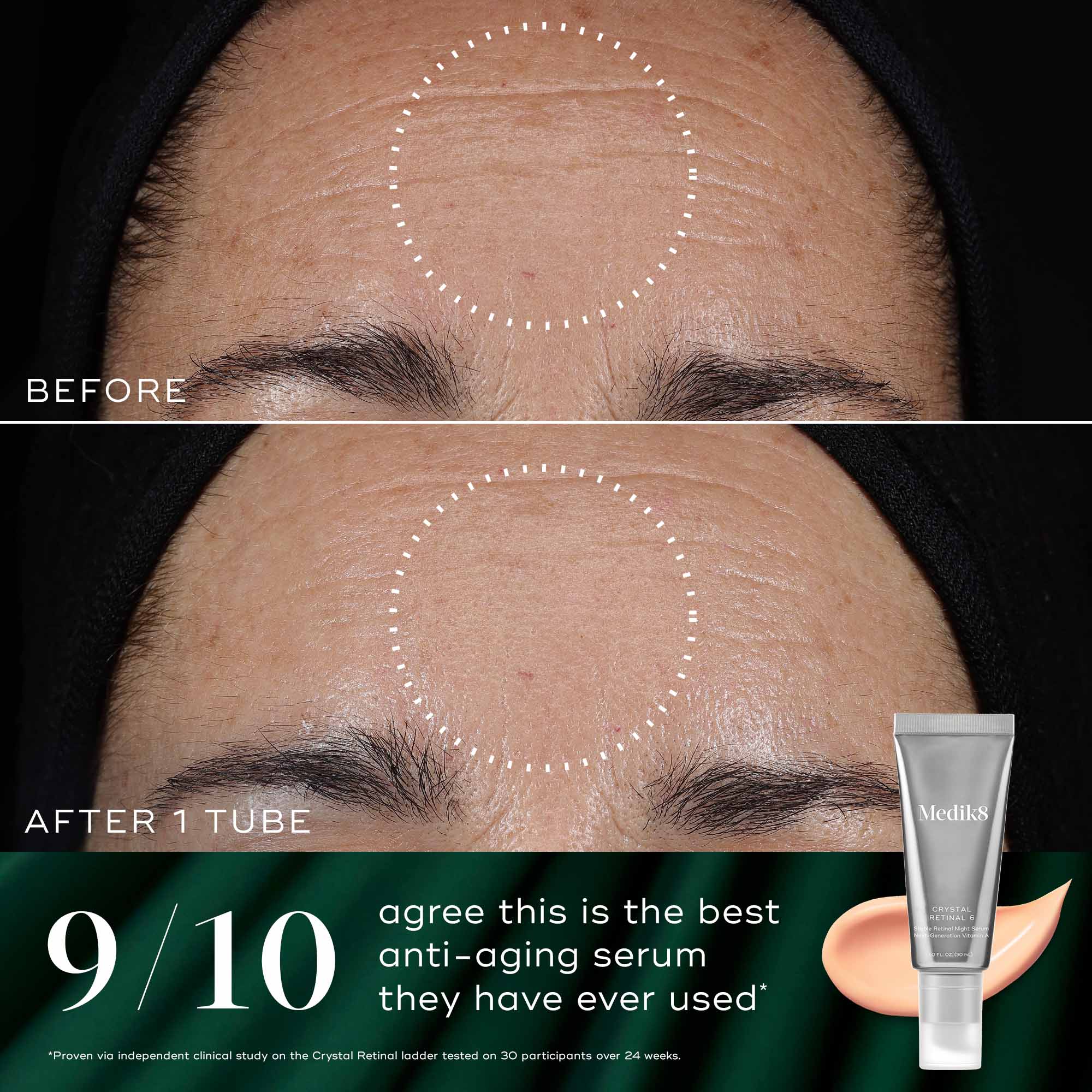 Medik8 Overnight Renewal Kit | Dermstore