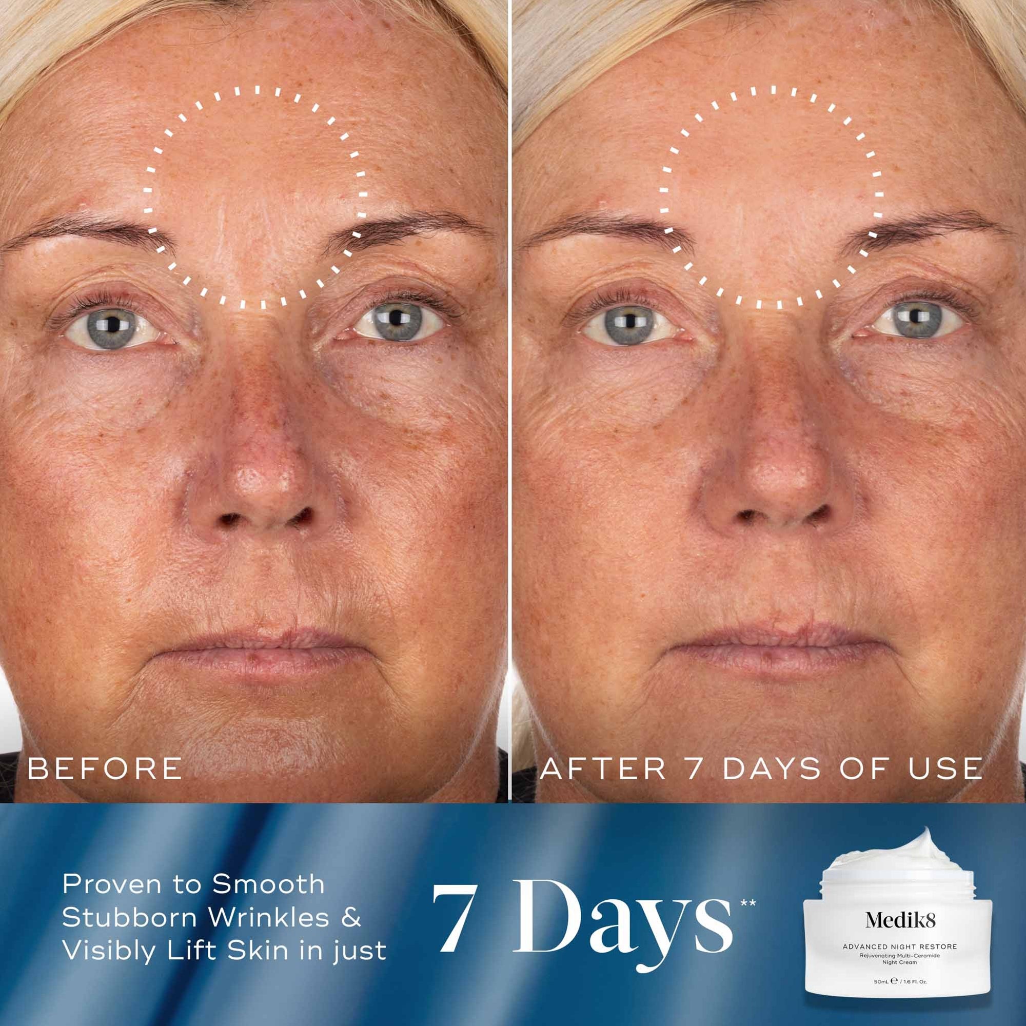 Medik8 Peptide Precision Kit | Dermstore