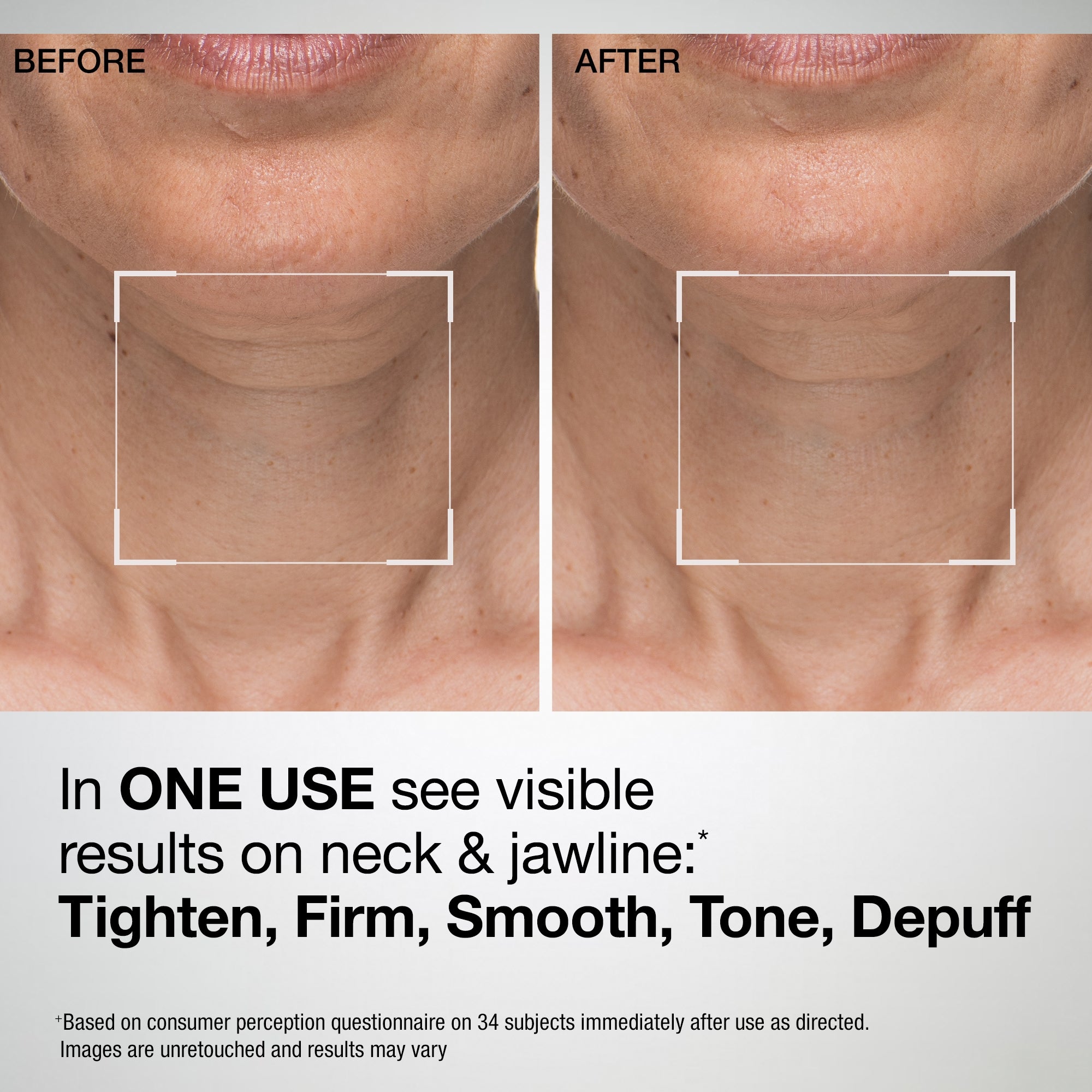 TL Advanced™ Sculpting Neck & Jawline Mask | Dermstore