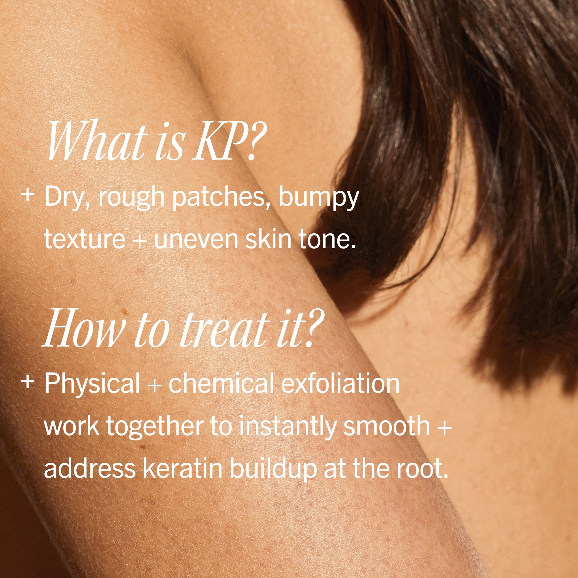First Aid Beauty KP Bump Eraser Body Scrub Peach 8.0 oz | Dermstore